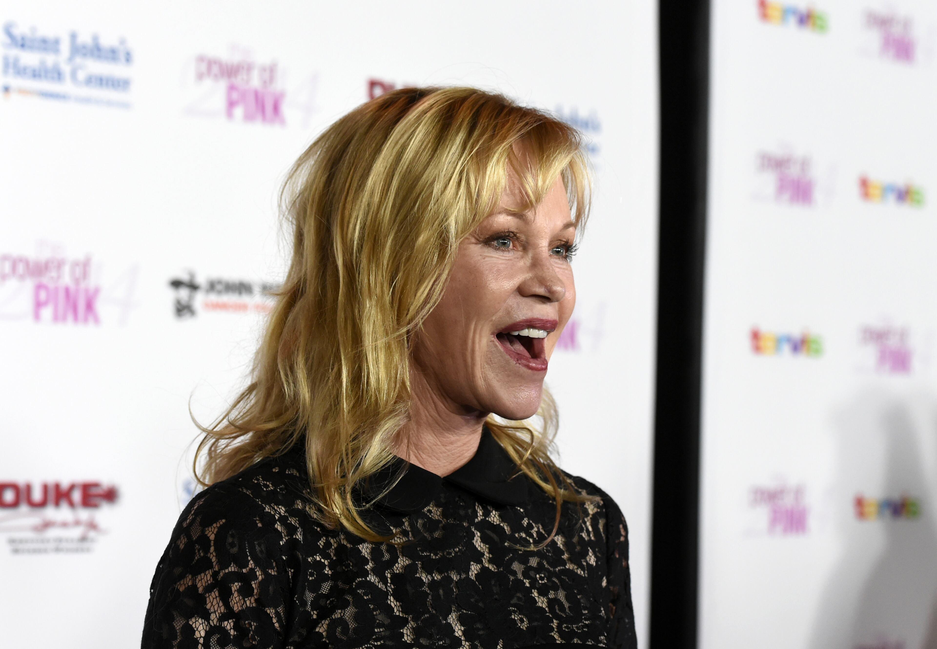 Actress Melanie Griffith had a tattoo reading "Antonio" -- for ex-husband Antonio Banderas -- removed after they couple split.