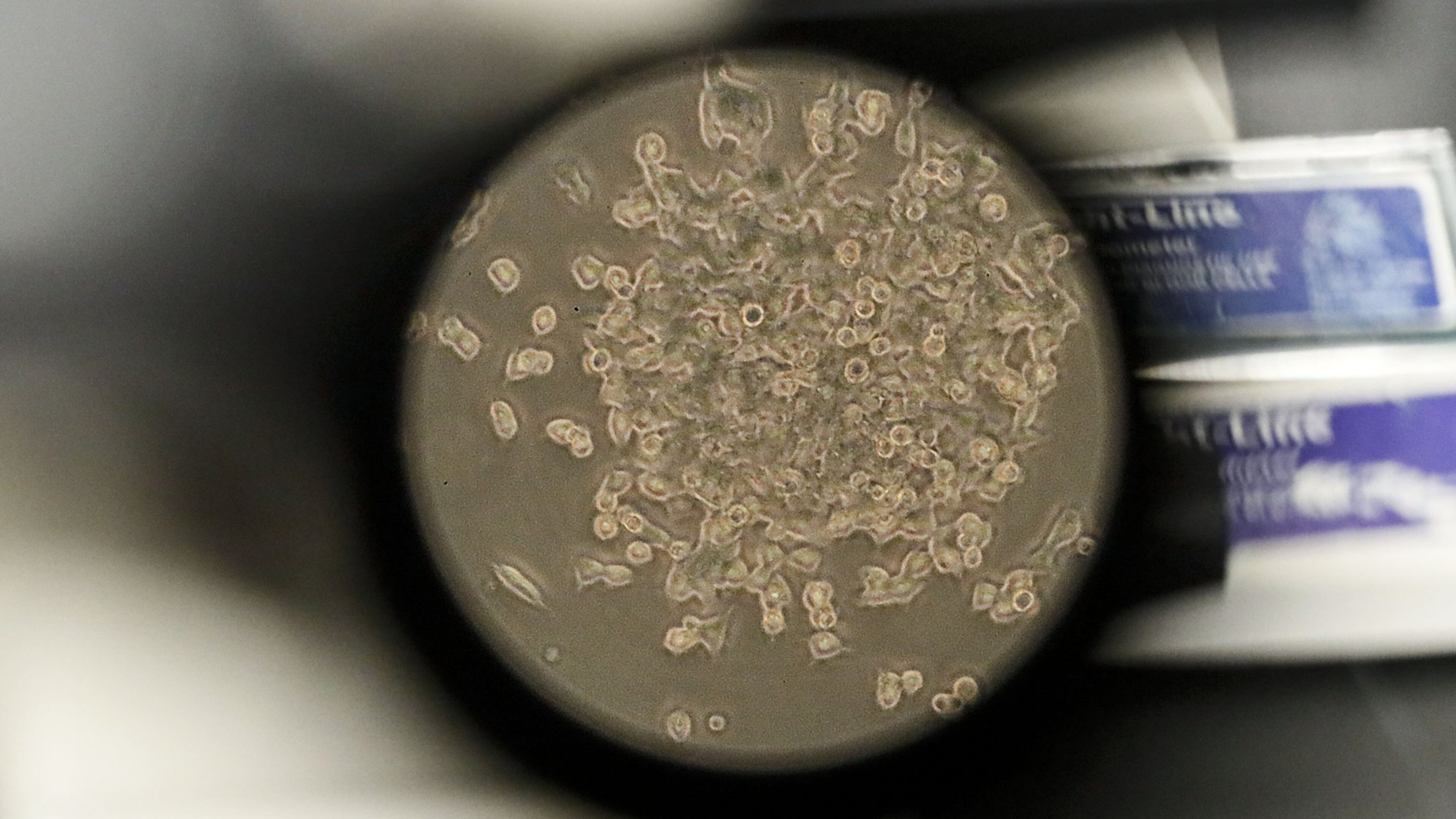 The view through a microscope at Smyrna-based GeoVax of one of the vaccine candidates for COVID-19 that the lab is working on. Bob Andres / robert.andres@ajc.com