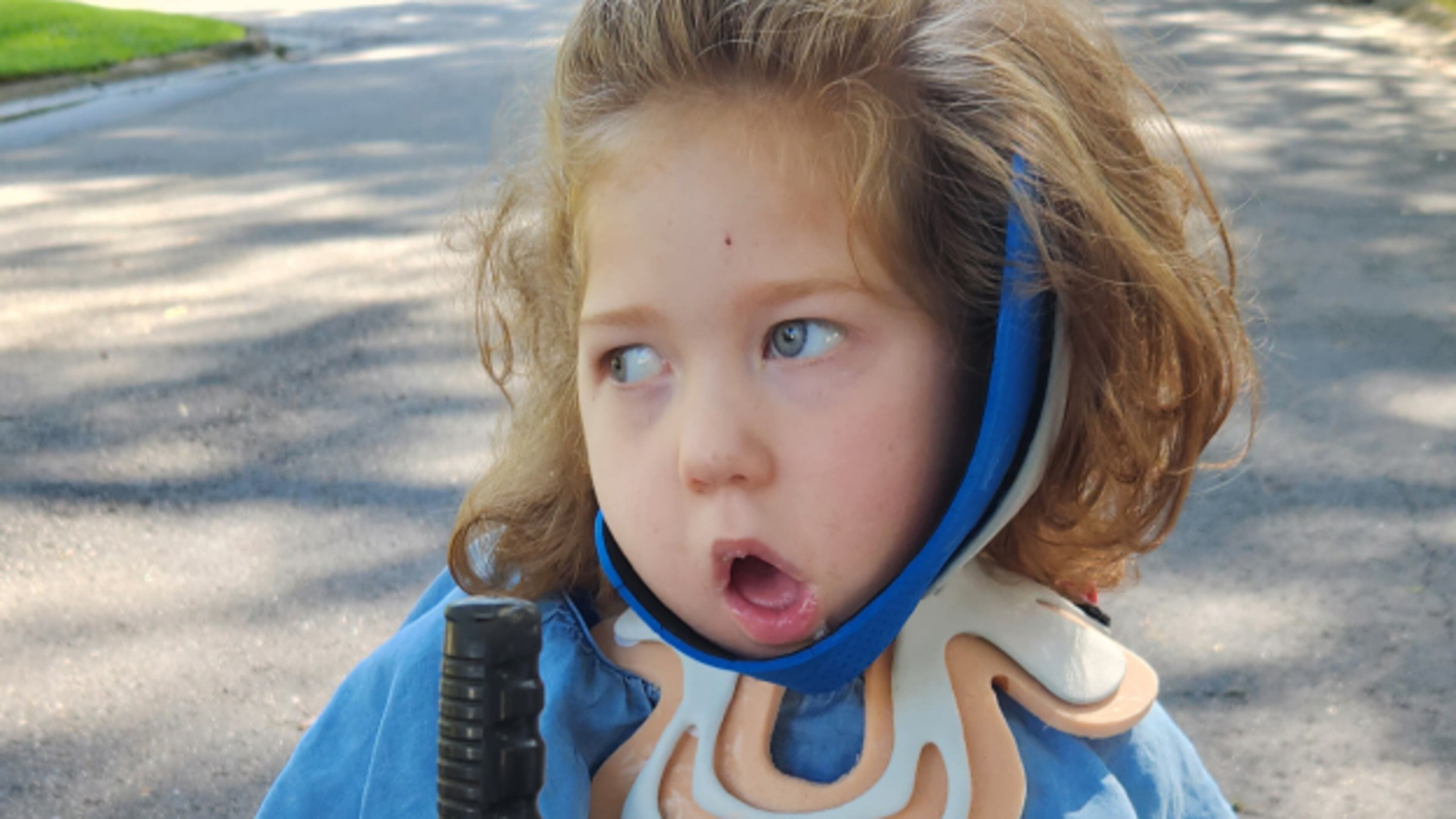 Catherine Reed, 8, is able to hold up her head independently for the first time thanks to a cutting edge, 3D-printed collar created by Brian Emling, an orthotist and prosthetist at Children's Healthcare of Atlanta. (Courtesy of Mary Reed)