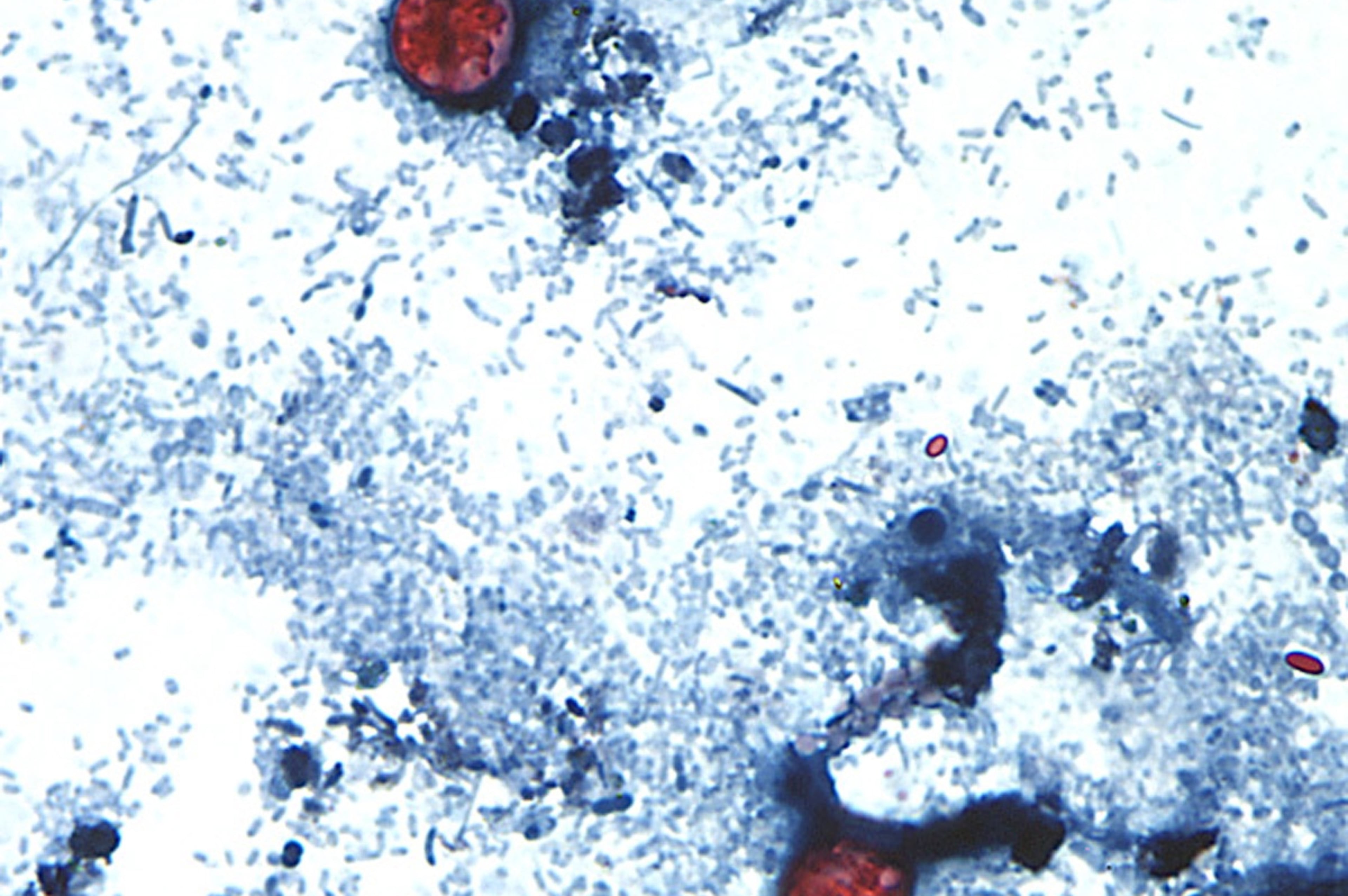 Cyclospora Outbreak