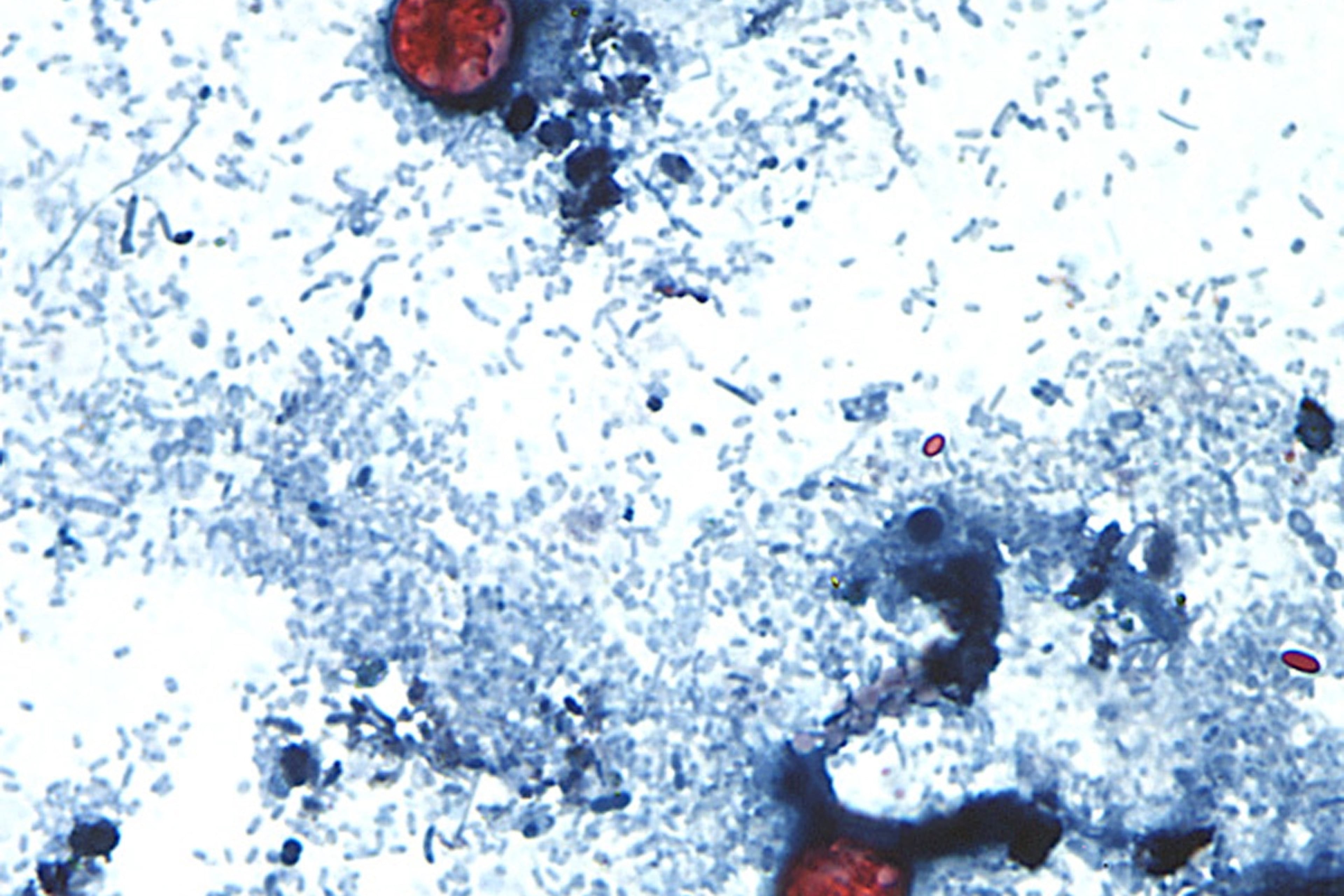 This undated photo taken through a microscope provided by the CDC shows Cyclospora cayetanensis oocysts found in a fresh stool sample which had been prepared with a formalin solution and stained with safranin. (CDC via AP)