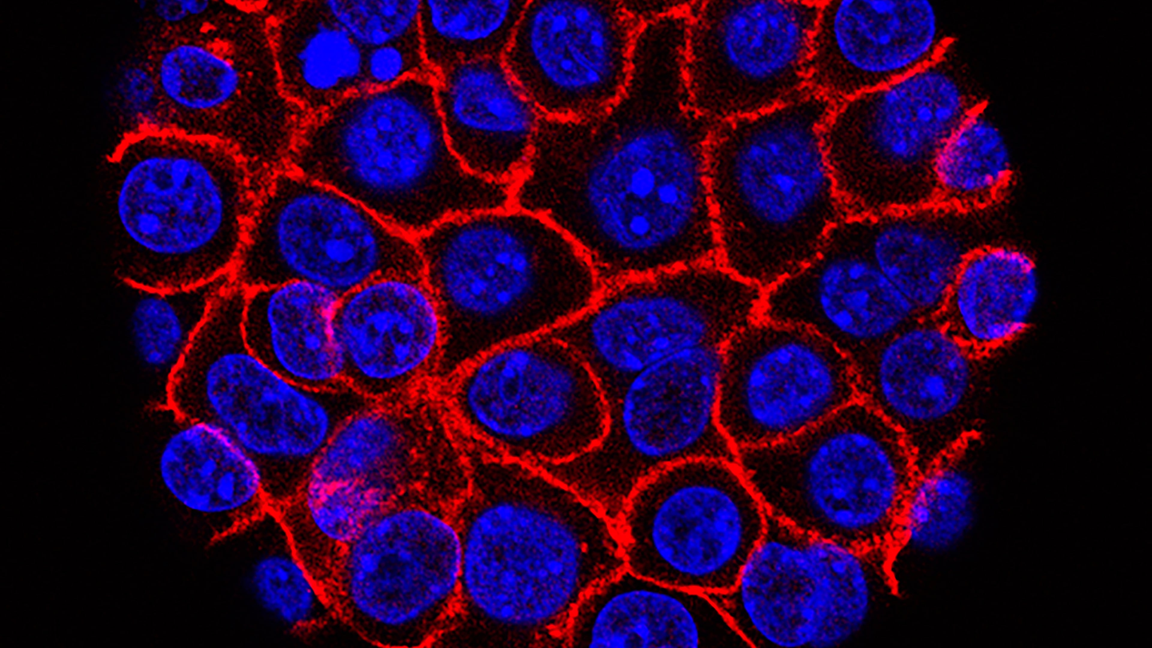 FILE - This undated microscope image from USC via the NIH shows pancreatic cancer cells, nuclei in blue, growing as a sphere encased in membranes, red. (Min Yu/Eli and Edythe Broad Center for Regenerative Medicine and Stem Cell Research at USC, USC Norris Comprehensive Cancer Center, File)