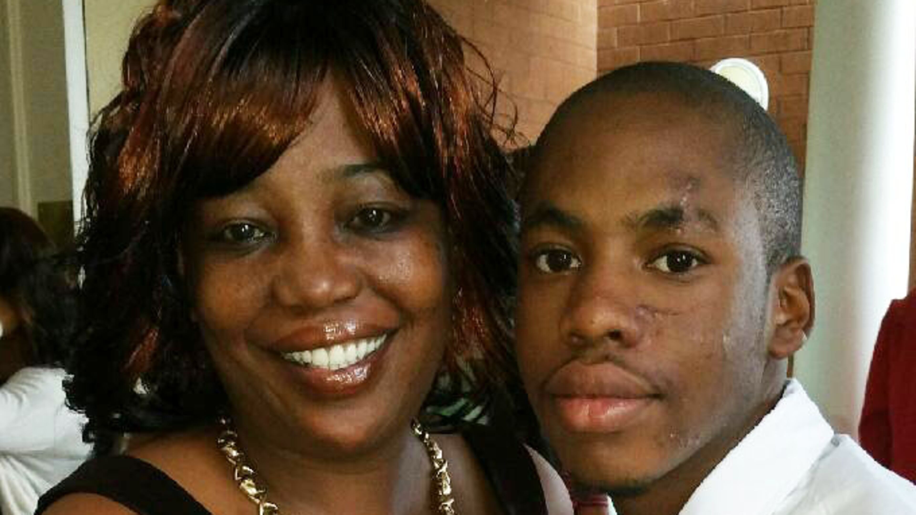 Sandra Mathis and son Michael Price, who the mother says is disabled and was hit by a car while walking to a DeKalb County Schools bus and now has facial scarring, along with metal parts in his arm and leg. The mother is suing the district. (Family Photo)
