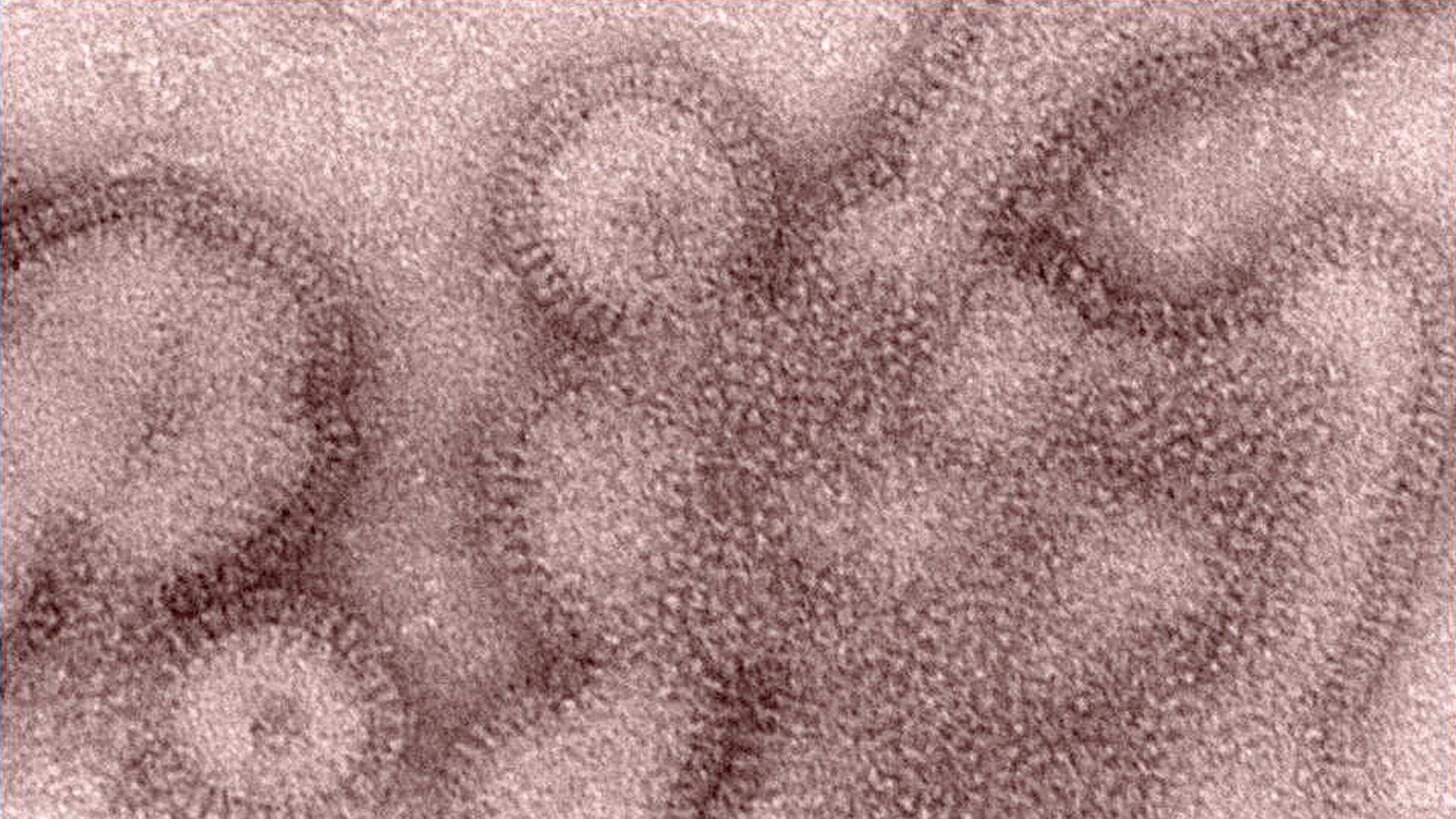 This is the H3N2 influenza virus, the type of flu that is most prevalent this winter. It’s especially adept at shifting quickly to evade immune systems and vaccines. Moreover, after it attacks and weakens a person, a different strain may come in and cause a dangerous secondary infection. That’s why doctors are still urging people to get vaccinated even this late in the flu season. (PHOTO from Centers for Disease Control and Prevention, Dr. Michael Shaw, Doug Jordan, via AP)