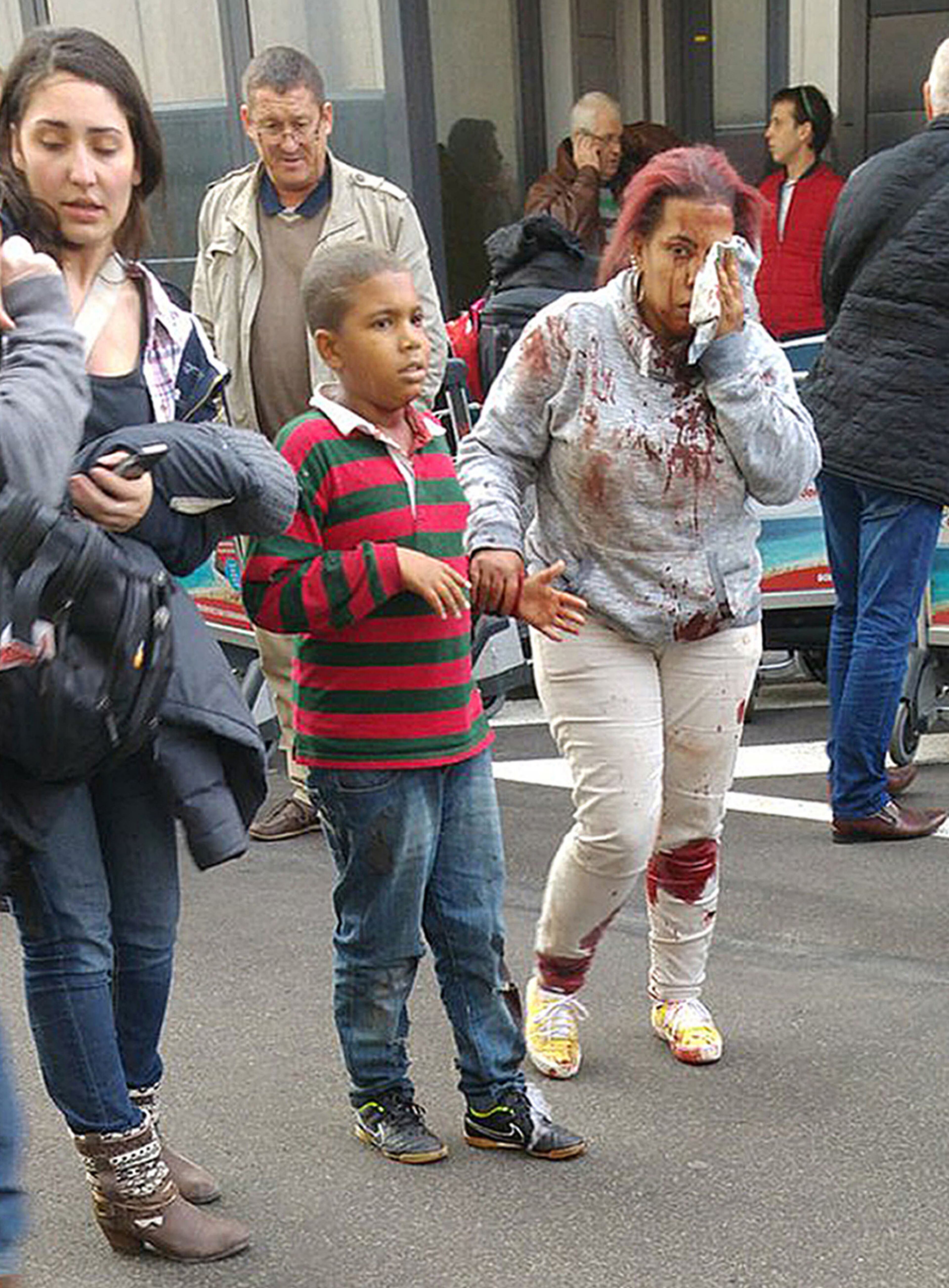 EXPLOSION VICTIMS--In this photo provided by David Crunelle, an injured woman leaves the scene at Brussels airport, after explosions rocked the facility in Brussels, Belgium, Tuesday March 22, 2016. Authorities locked down the Belgian capital on Tuesday after explosions rocked the Brussels airport and subway system, killing a number of people and injuring many more. Belgium raised its terror alert to its highest level, diverting arriving planes and trains and ordering people to stay where they were. Airports across Europe tightened security. (David Crunelle via AP)