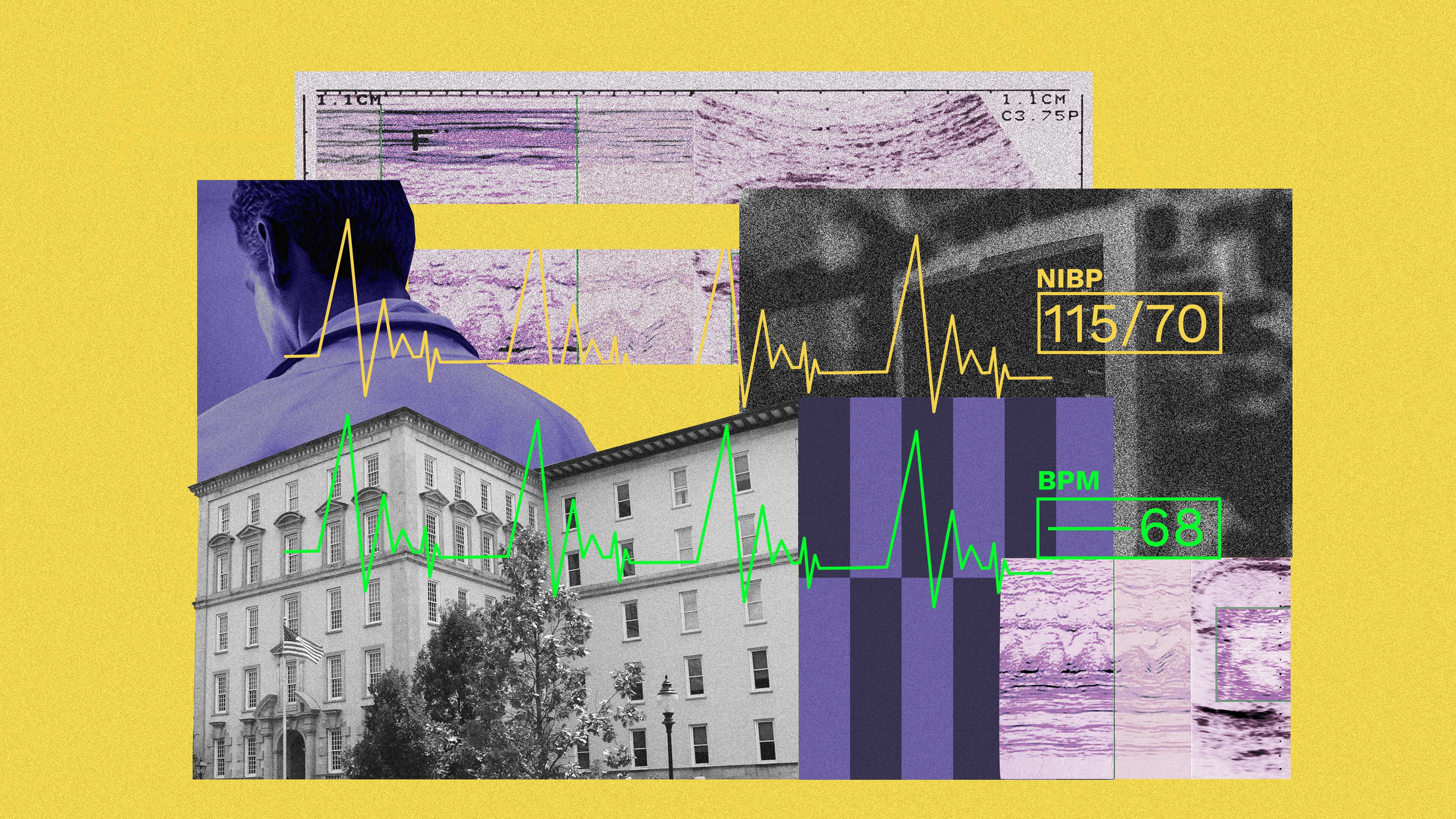 Image: Philip Robibero/AJC; Photos: Getty