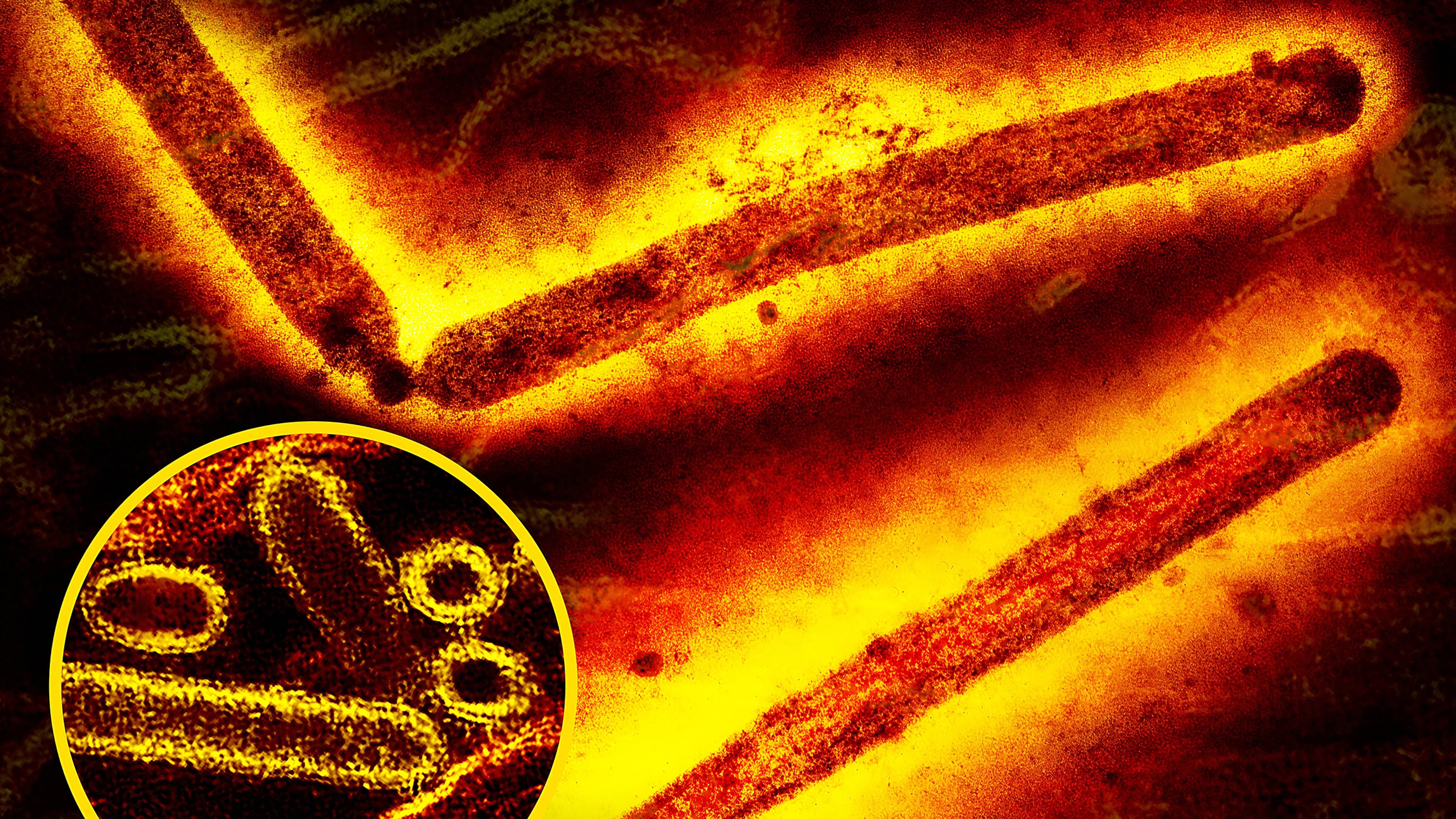Influenza A H5N1/bird flu virus particles round and rod-shaped red and yellow. Creative composition and colorization/effects by NIAID transmission electron micrograph imagery is courtesy of CDC. (Imago via Zuma Press/TNS)