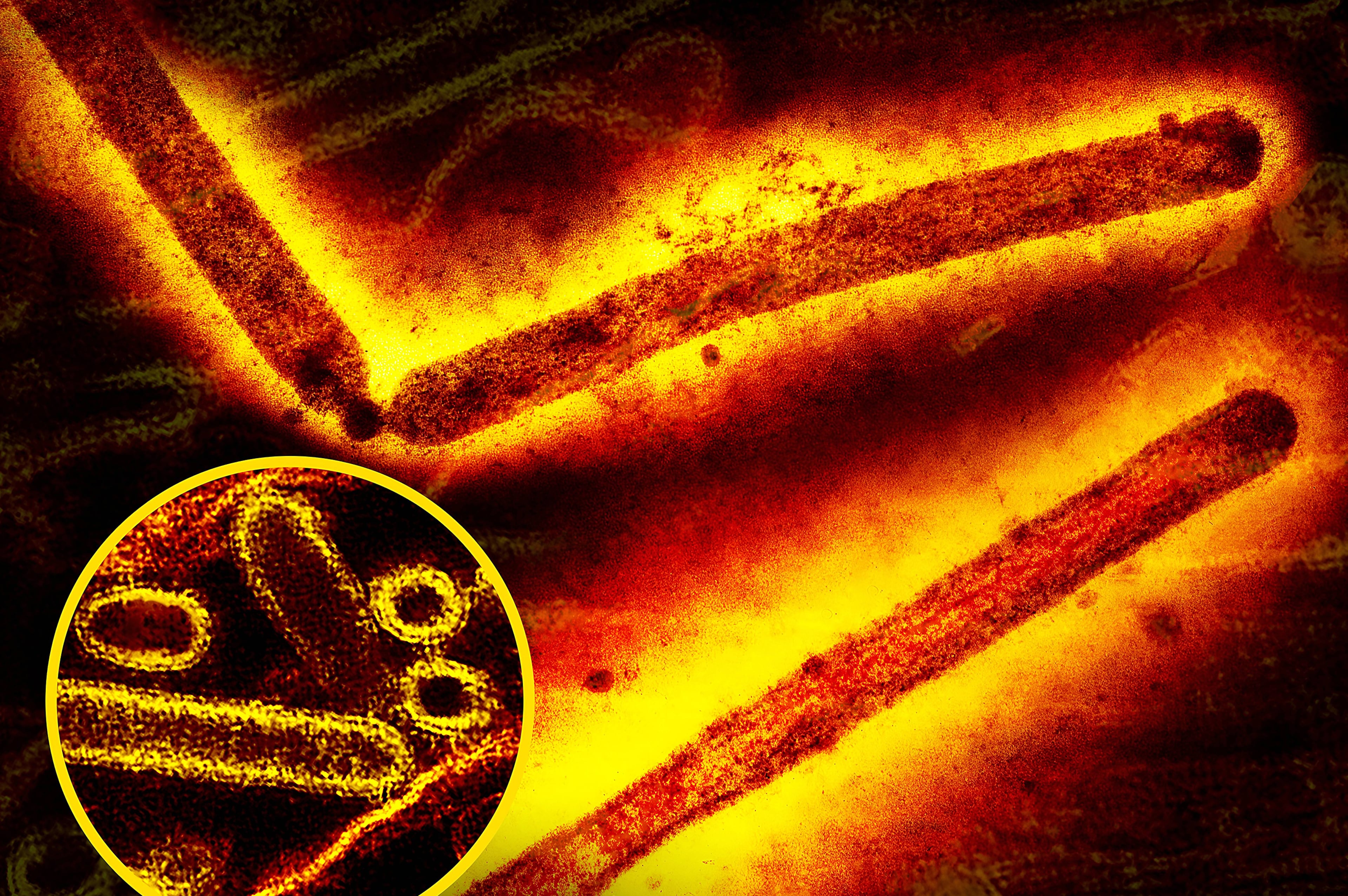 US-NEWS-MED-CALIF-BIRDFLU-ZUM