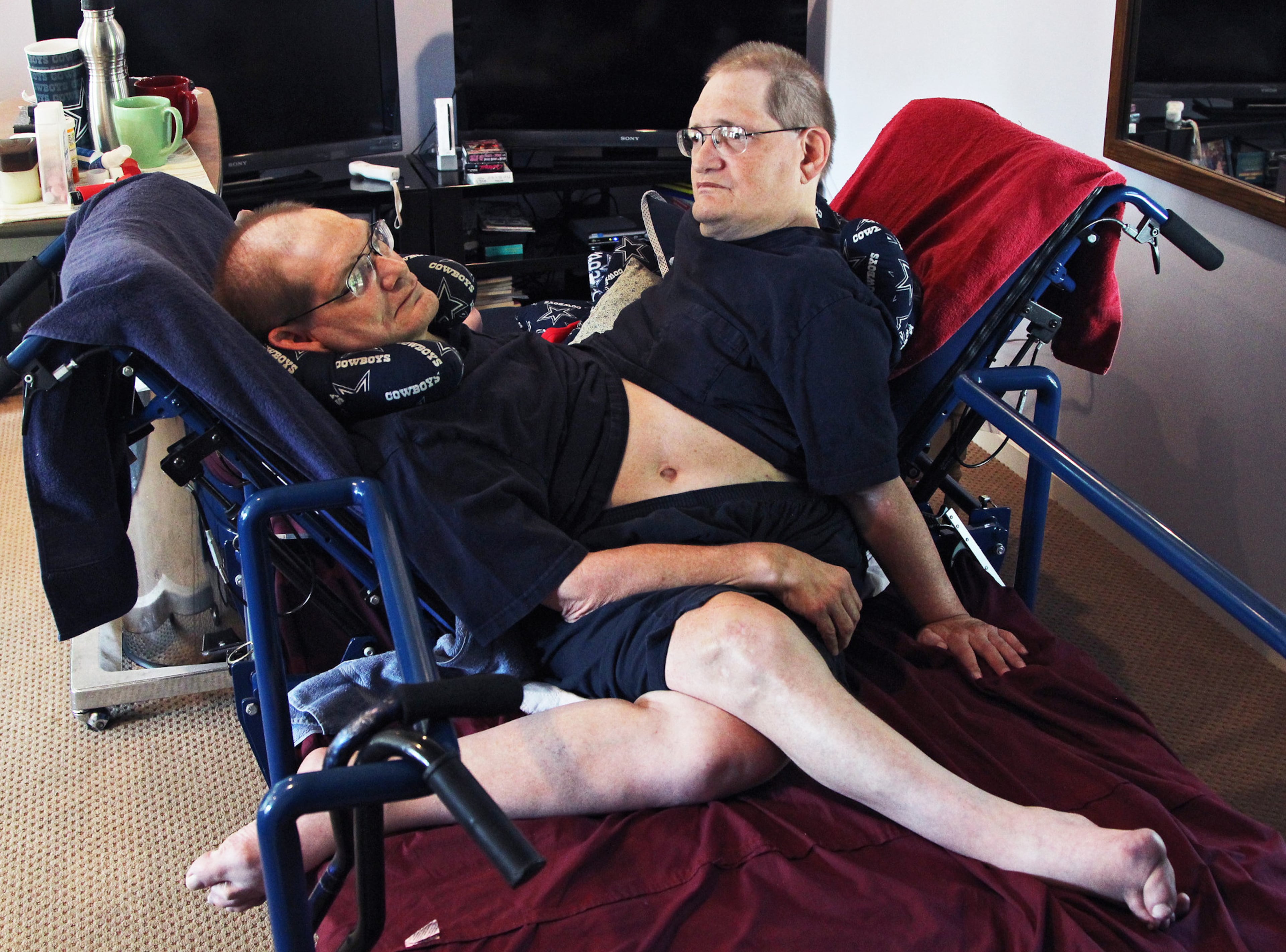 Donnie, left, and Ronnie Galyon sit inside their Beavercreek, Ohio, home, Wednesday, July 2, 2014. Donnie and Ronnie are nearing the record for longest living conjoined twins. The Galyons, born Oct. 28, 1951 at St. Elizabeth Hospital in Dayton, now live in Beavercreek with their brother, Jim Galyon and his wife Mary, who provide 24-7 care for them. (AP Photo/The Daily News, Drew Simon)