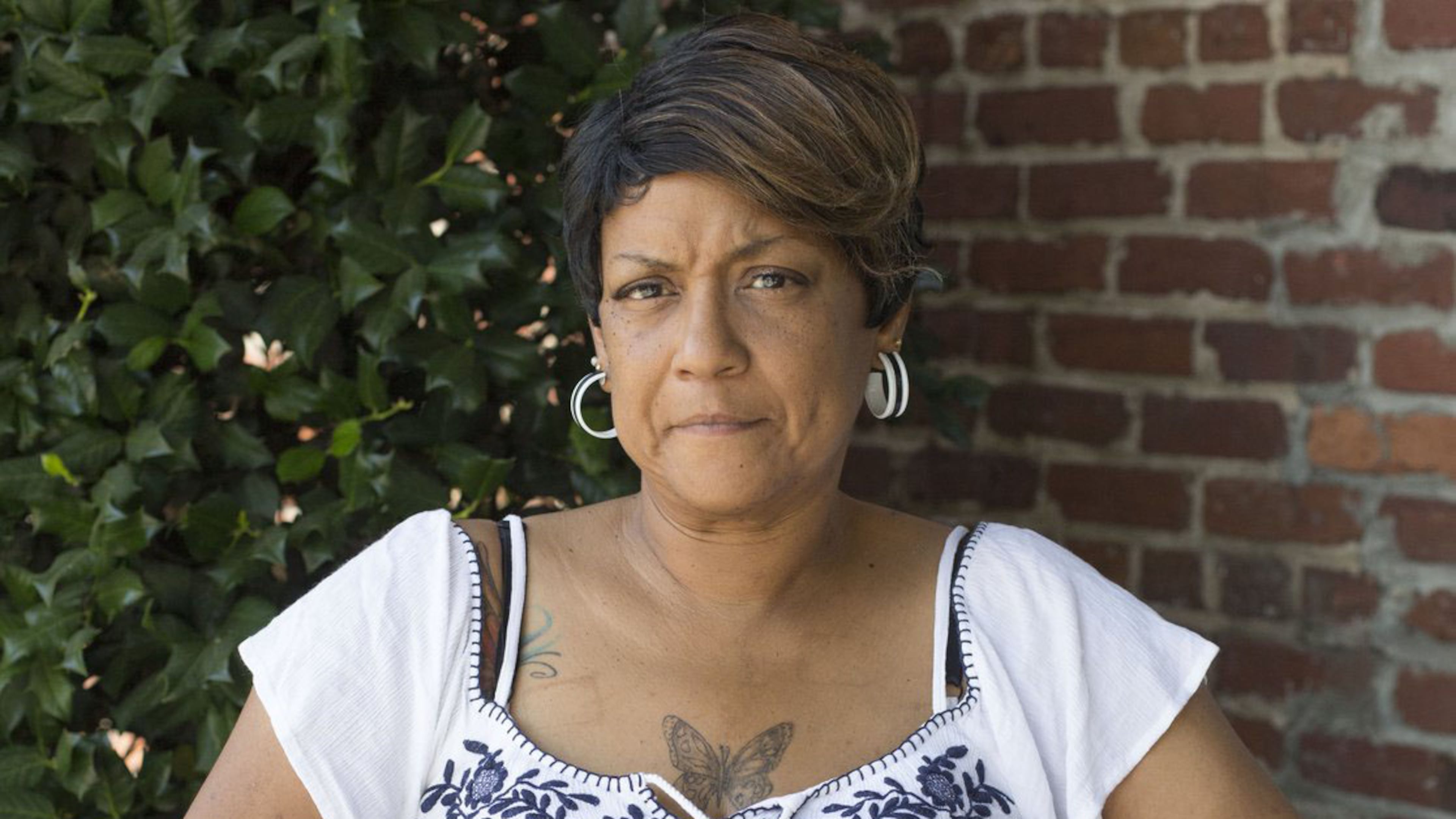 Doctors at Grady Memorial Hospital in Atlanta were forced to amputate Kimerly Finger’s right leg below the knee because of an infection that took hold months earlier while she was in prison. EMILY JENKINS/ EJENKINS@AJC.COM