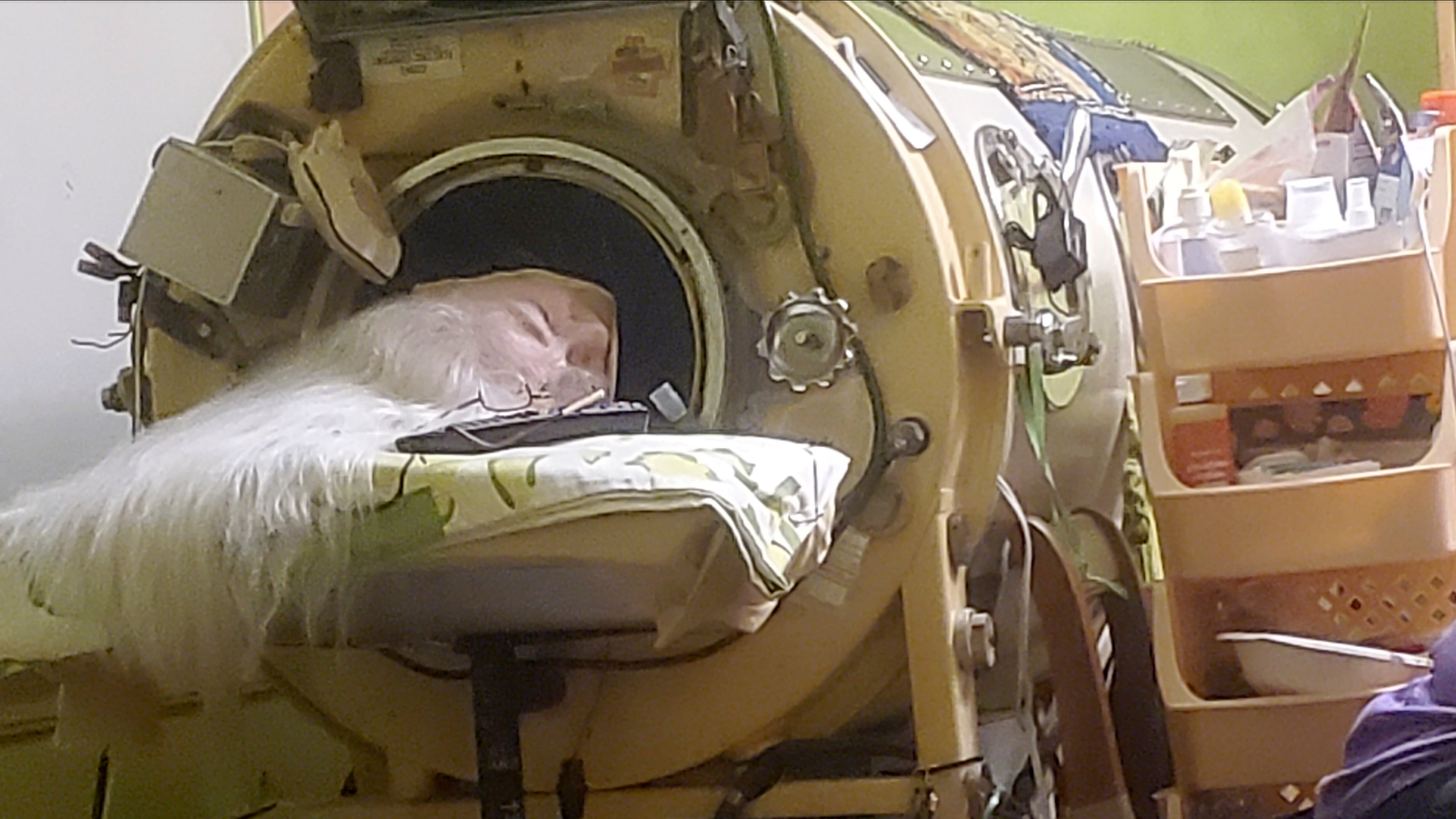 In this photo provided by Cindy McVey, her sister Martha Lillard rests in her iron lung on Friday, February 6, 2026 in Shawnee, Okla. (Cindy McVey via AP)