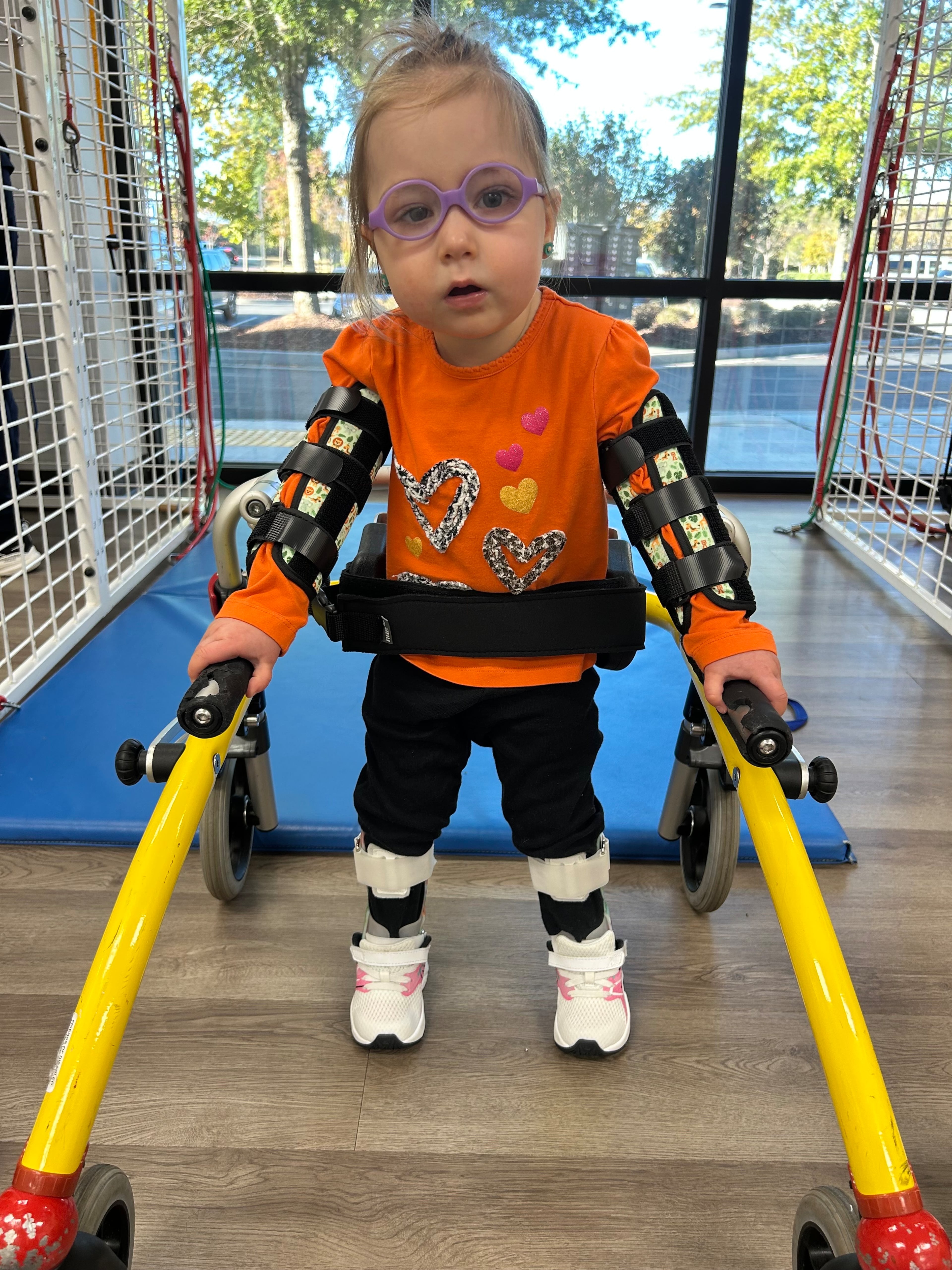 Charlee Kilpatrick, 3, has a muscular disability and needs lots of therapy and equipment to help her muscles and movement develop. That includes a walker, limb equipment and a wheelchair. (Courtesy of the Kirkpatrick family.)