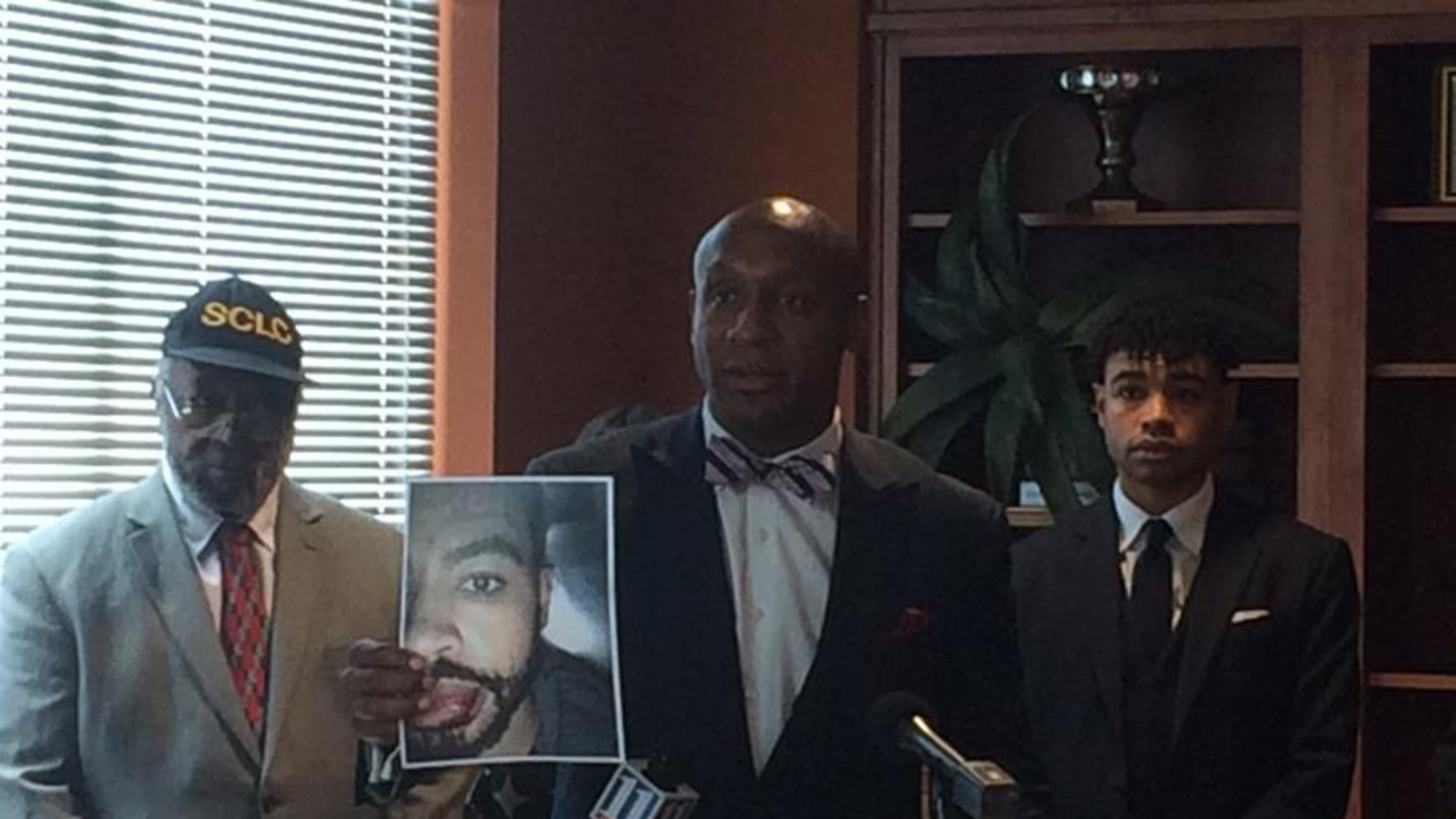 Attorney Mawuli Davis (center) holds a photo of client Corey Toole’s injuries. Toole (right) is suing the city of Atlanta and police officers, accusing them of forcibly throwing him to the ground and unlawfully arresting him. (Photo: RAISA HABERSHAM / RAISA.HABERSHAM@AJC.COM)