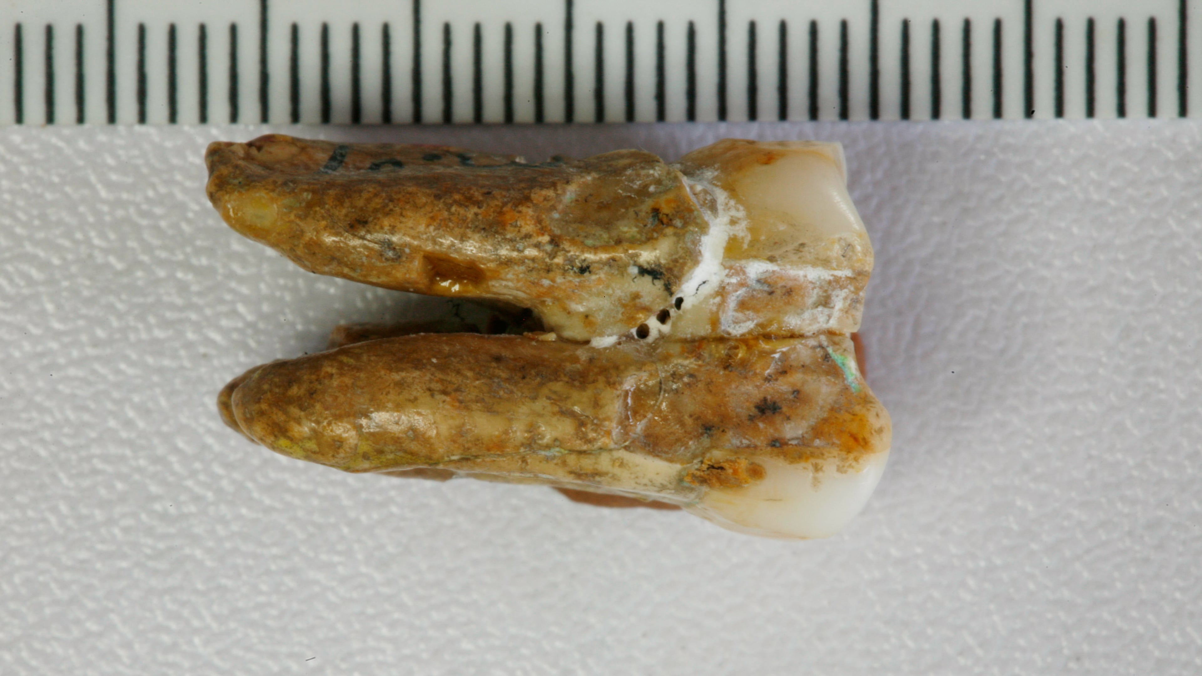 This undated image provided by the Institute of Vertebrate Paleontology and Paleoanthropology, Chinese Academy of Sciences shows an ancient tooth found at the Zhoukoudian archaeological site in eastern China. (Kai Zhou/Institute of Vertebrate Paleontology and Paleoanthropology, Chinese Academy of Sciences via AP)