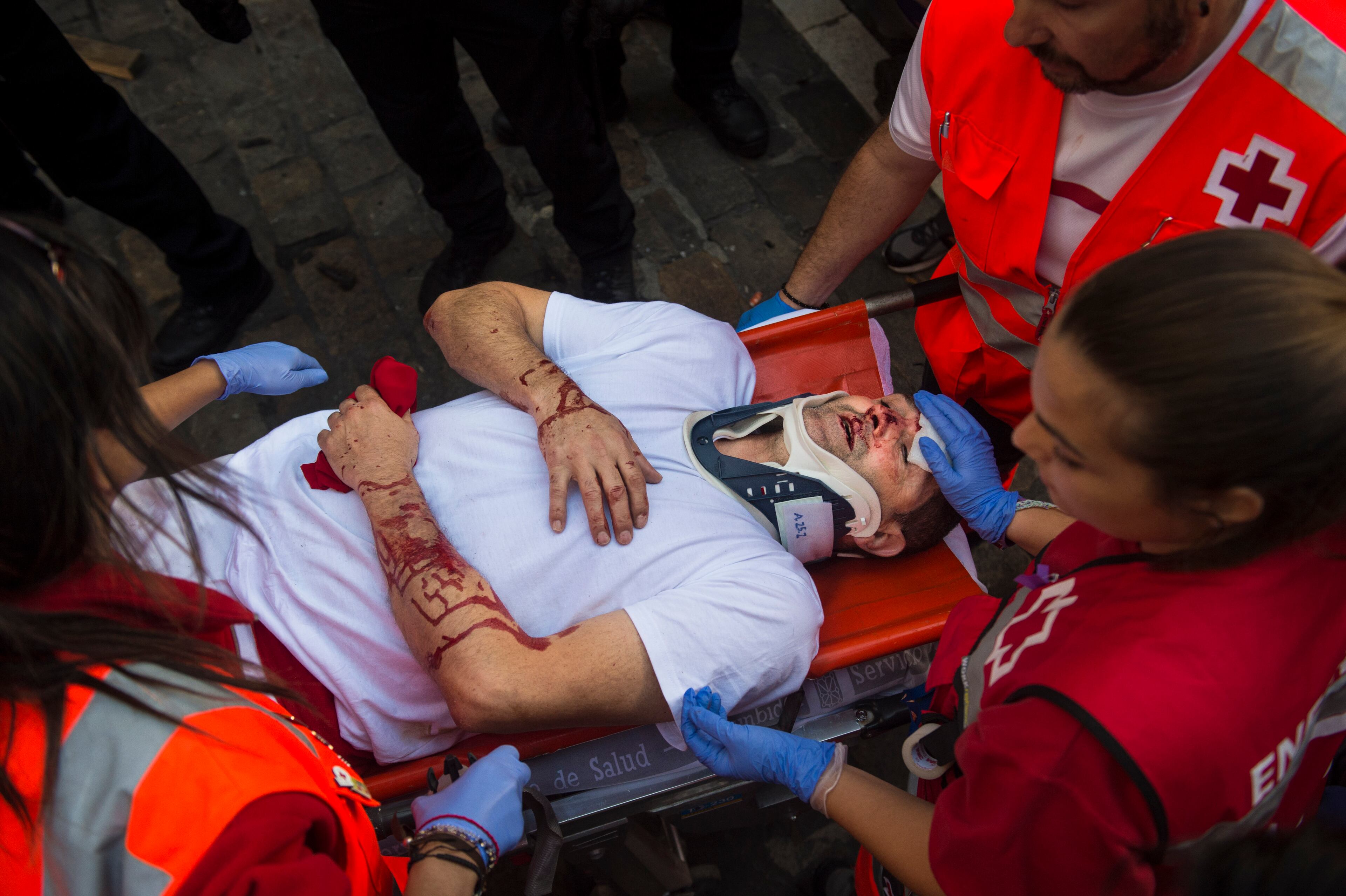 A participant is helped by medical personnel after he was injured during the running of the bulls at the San Fermin Festival in Pamplona, Spain, Thursday, July 9, 2015. Revelers from around the world arrive in Pamplona every year to take part in some of the eight days of the running of the bulls. (AP Photo/Alvaro Barrientos)
