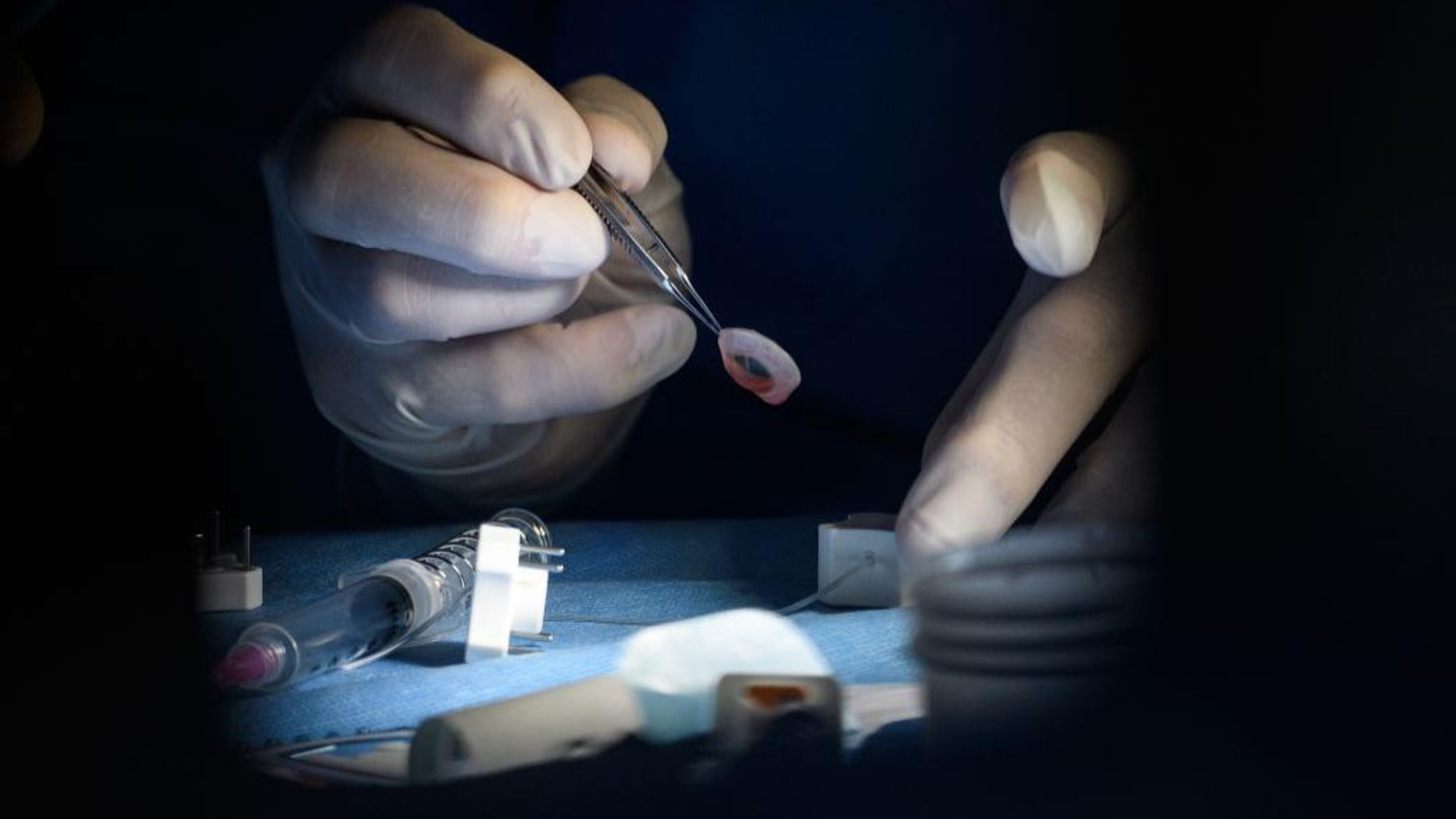 Doctors perfomed open fetal surgery in Dallas during June.