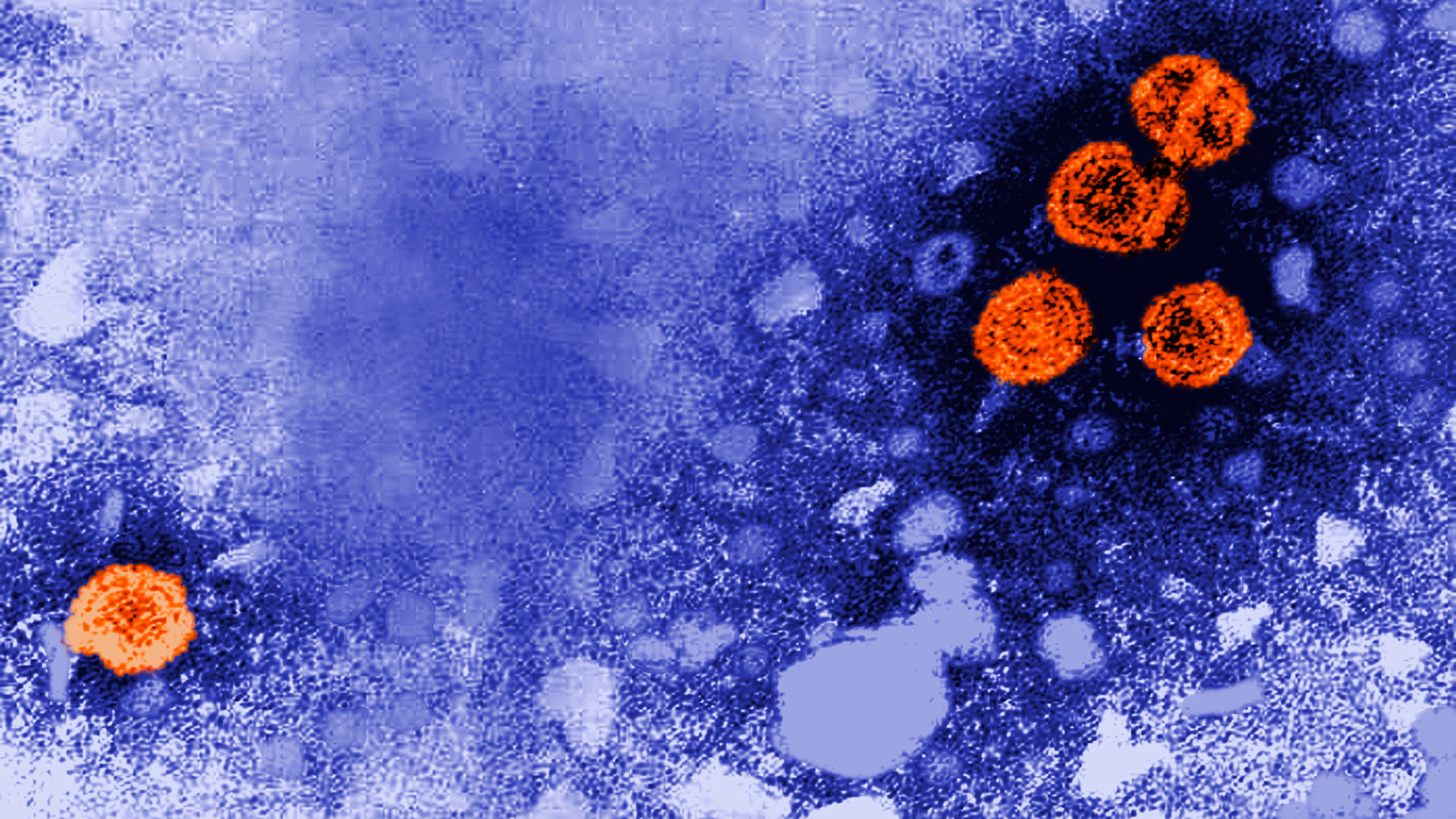 FILE - This 1981 electron microscope image made available by the U.S. Centers for Disease Control and Prevention shows hepatitis B virus particles, indicated in orange. (Dr. Erskine Palmer/CDC via AP, File)