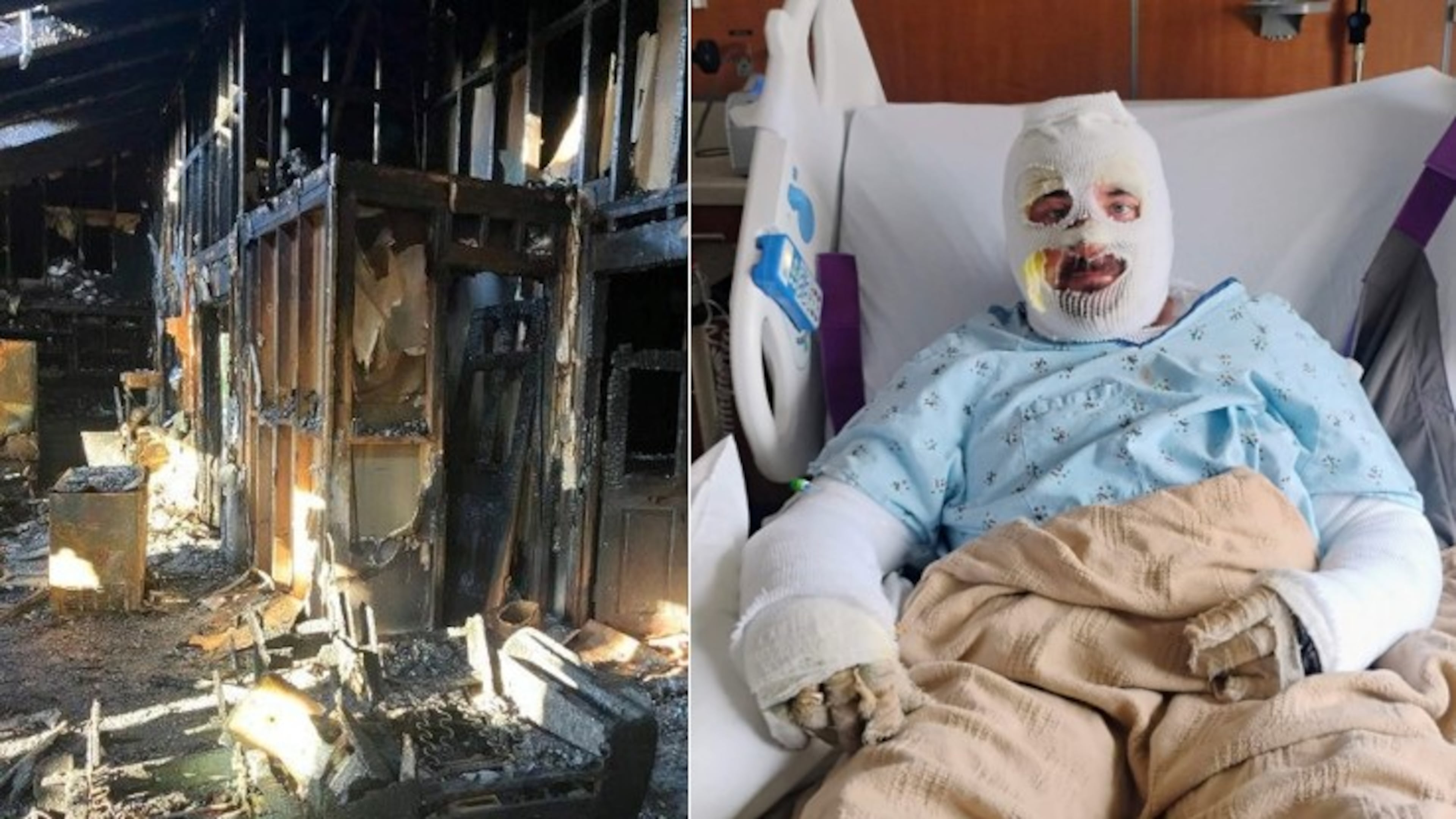 Robert Milam's home in Bartow County was destroyed by a fire. The Kennesaw State University police officer was severely burned while trying to get his fiancee out of the house. (Courtesy)