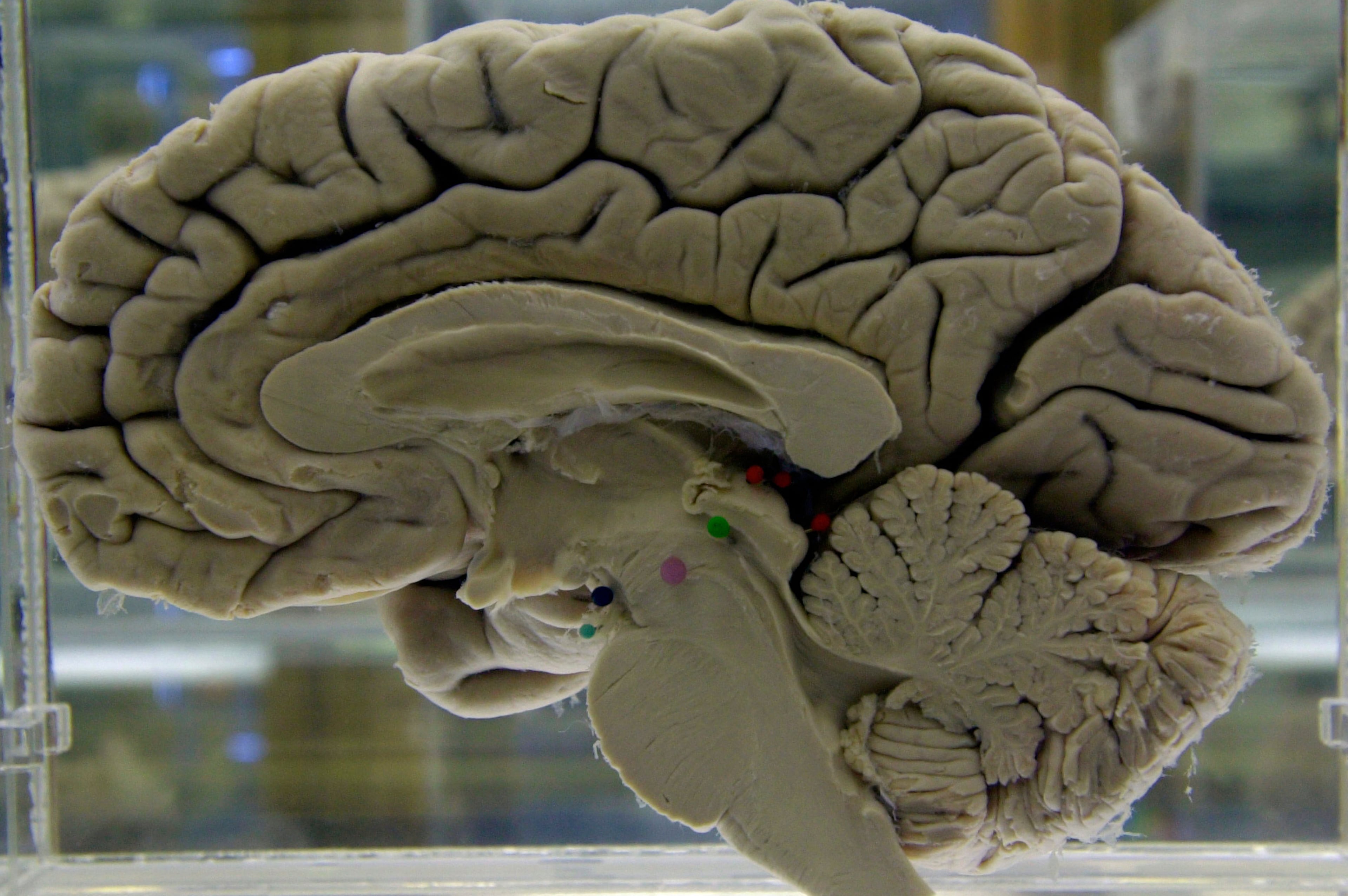 Be Well-Dementia Risk