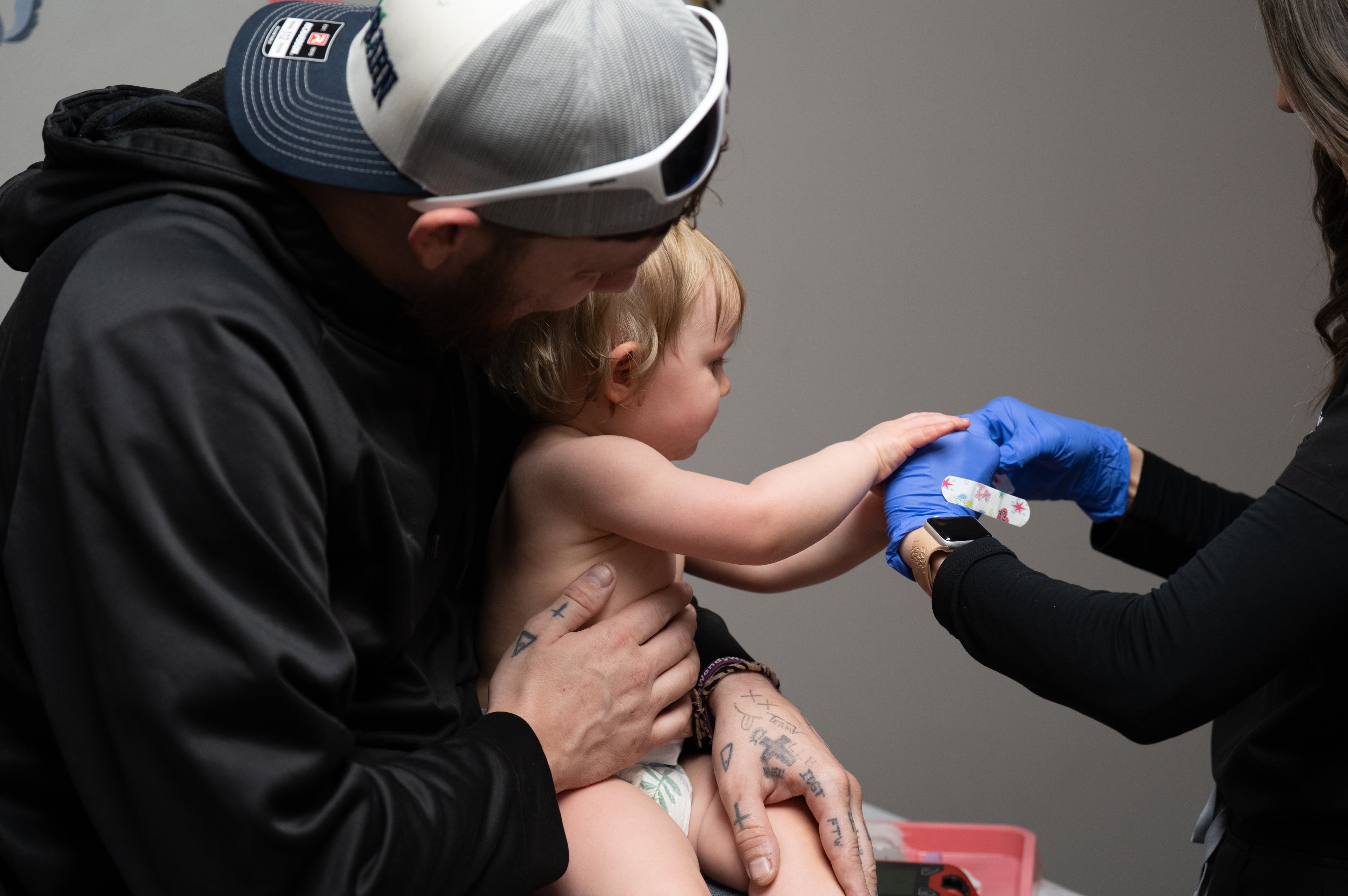 Measles-Babies