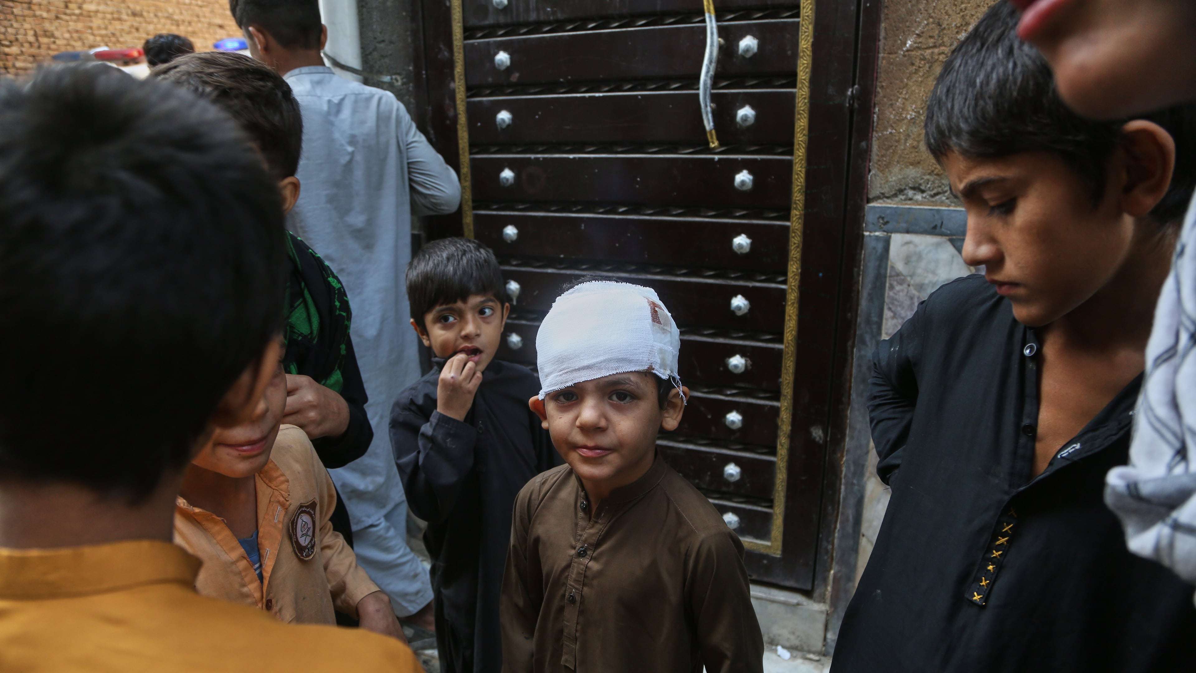 Muhammad Murtaza, center, who was injured in Thursday's roof collapse at a private school, stands with other children outside his home, in Peshawar, Pakistan, Friday, Oct. 16, 2026. (AP Photo/Muhammad Zubair)