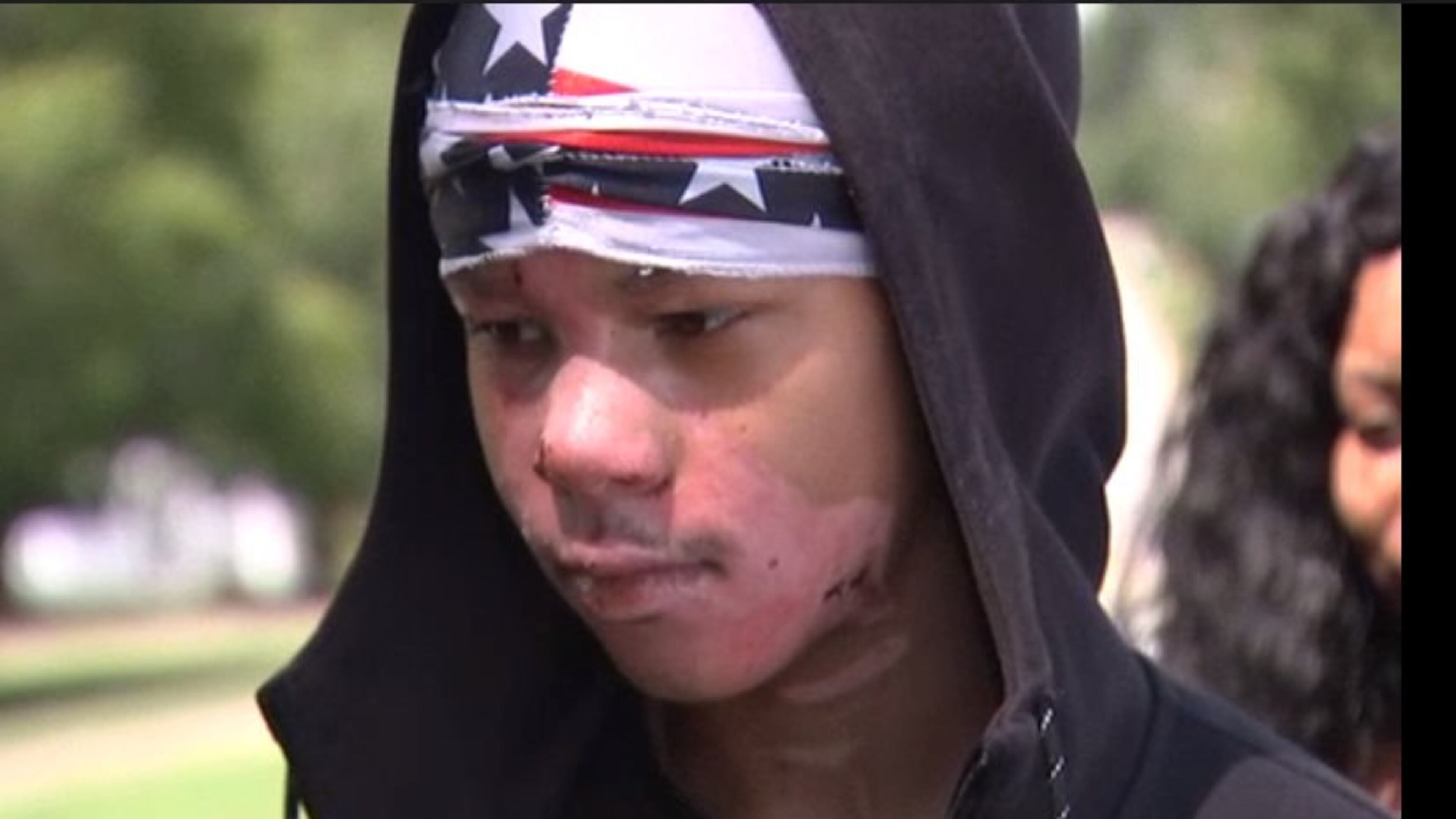 Malachi McFadden, 15, was badly burned during an experiment that went wrong in his high school chemistry class.