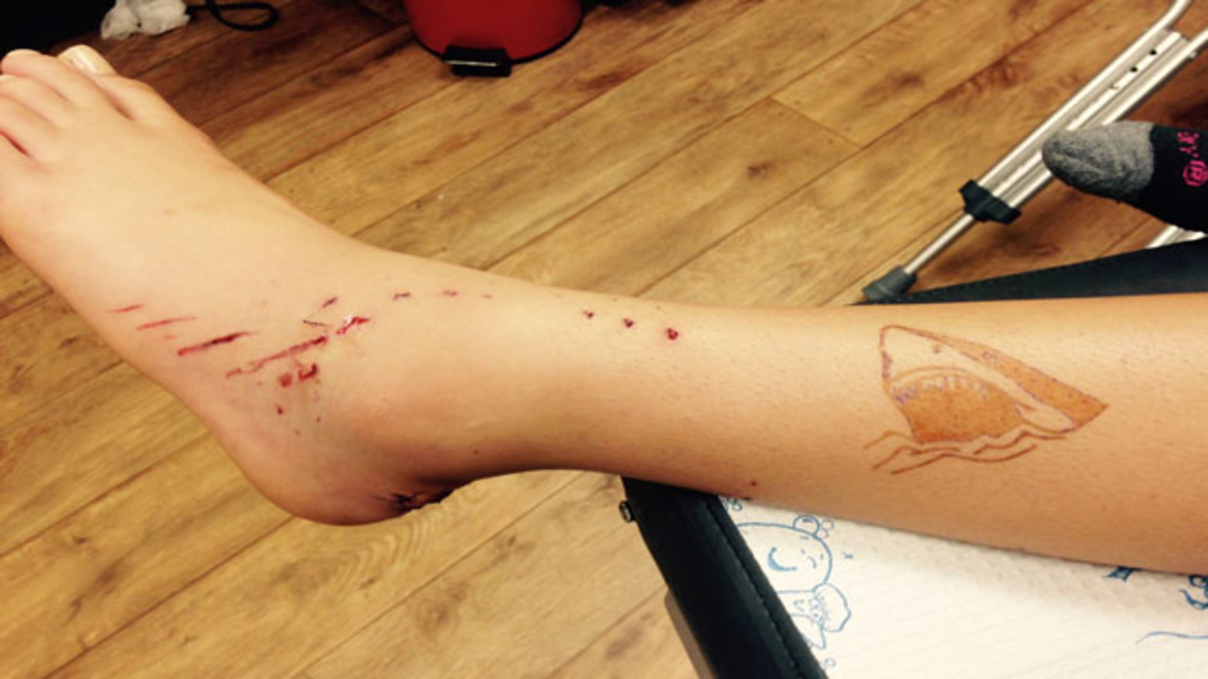 This weekend a Seminole County student was attacked by a shark off the coast of Cocoa Beach.