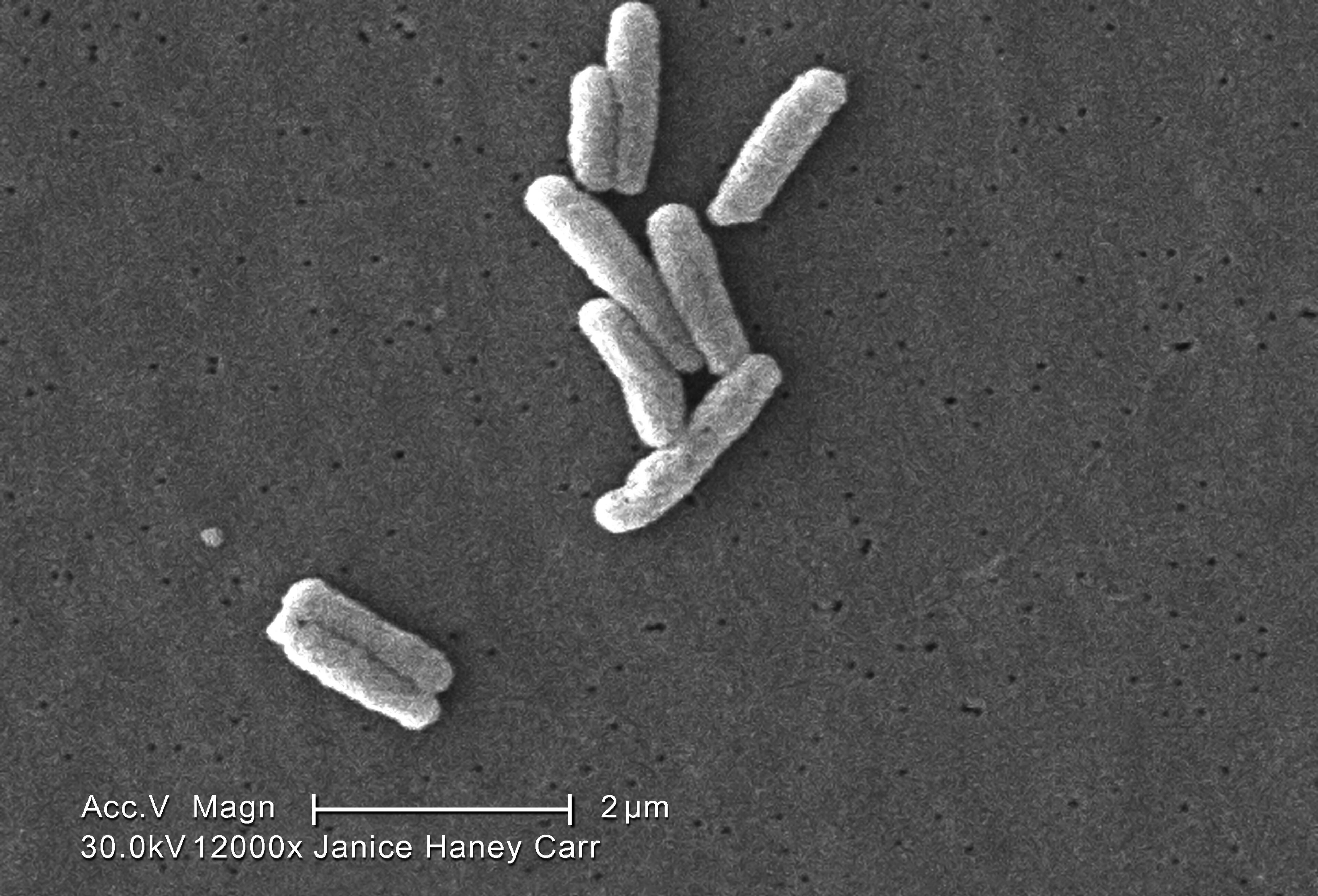 Legionella pneumophila bacteria, as seen at a magnification of 12000X via a scanning electron micrograph. Although this type of bacteria was around before 1976, more illness from Legionnaires’ disease is being detected now since the CDC and medical professionals are now looking for the disease whenever a patient has pneumonia.