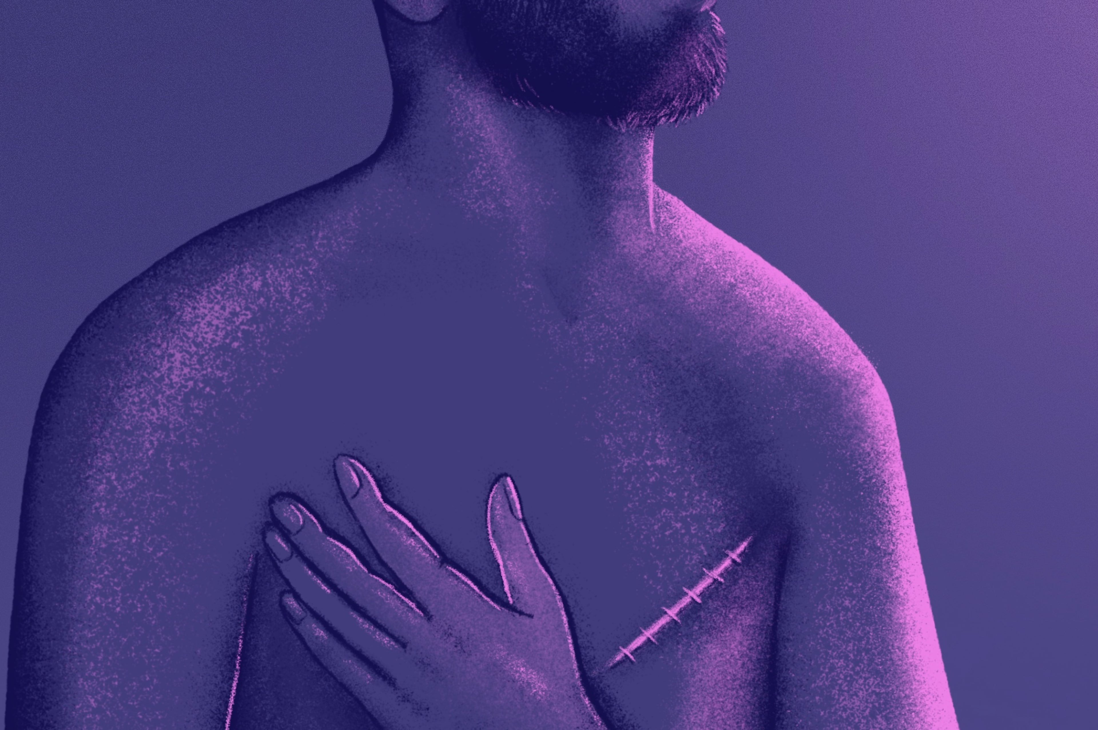 Breast Cancer - Men