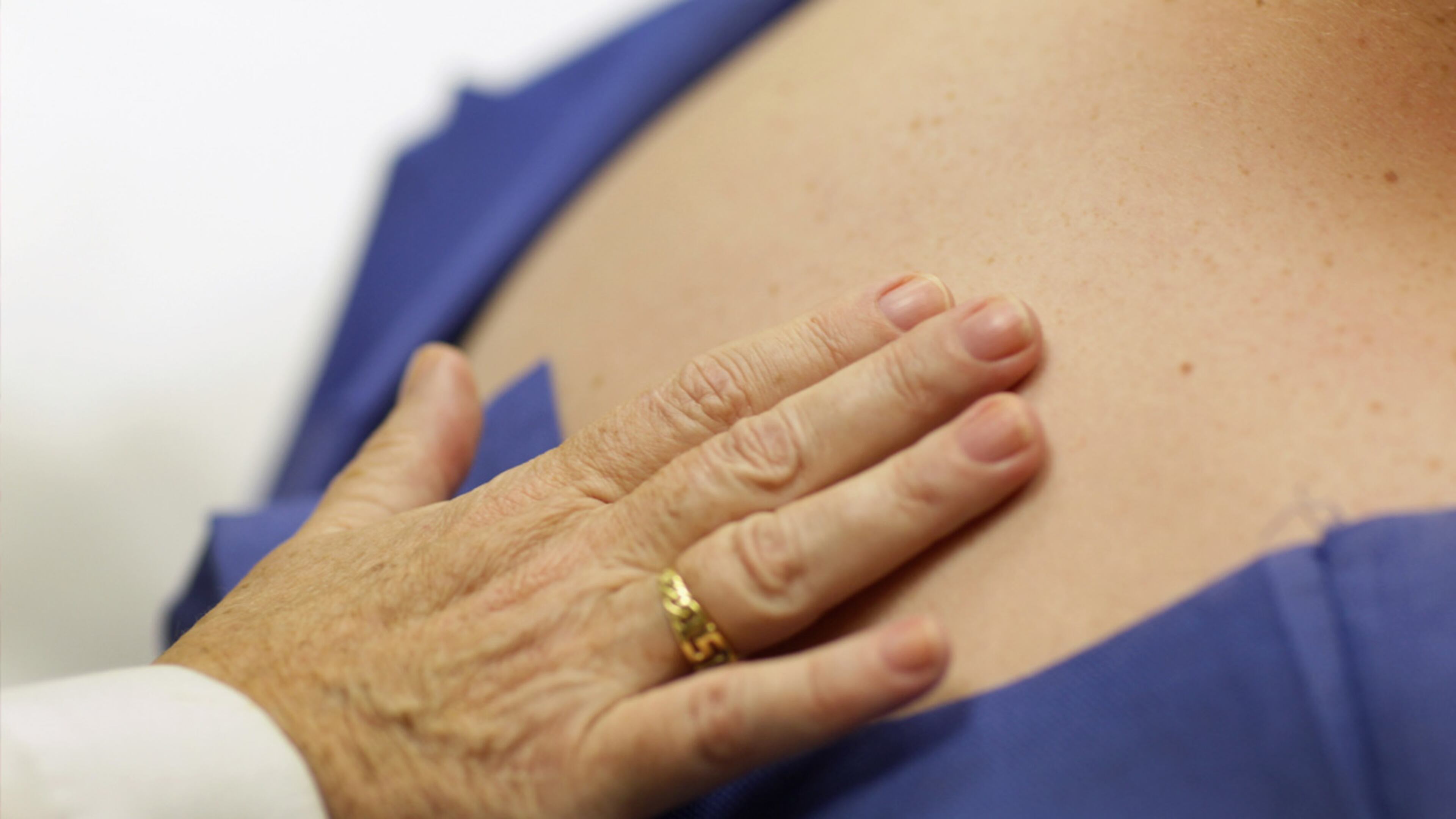 Doctor Antonella Tost, Dermatologist University of Miami School of Medicine, examines Michael Casa Nova,12, for symptoms of skin cancer due to sun exposure on June 15, 2011 in Miami, Florida. (Photo by Joe Raedle/Getty Images)