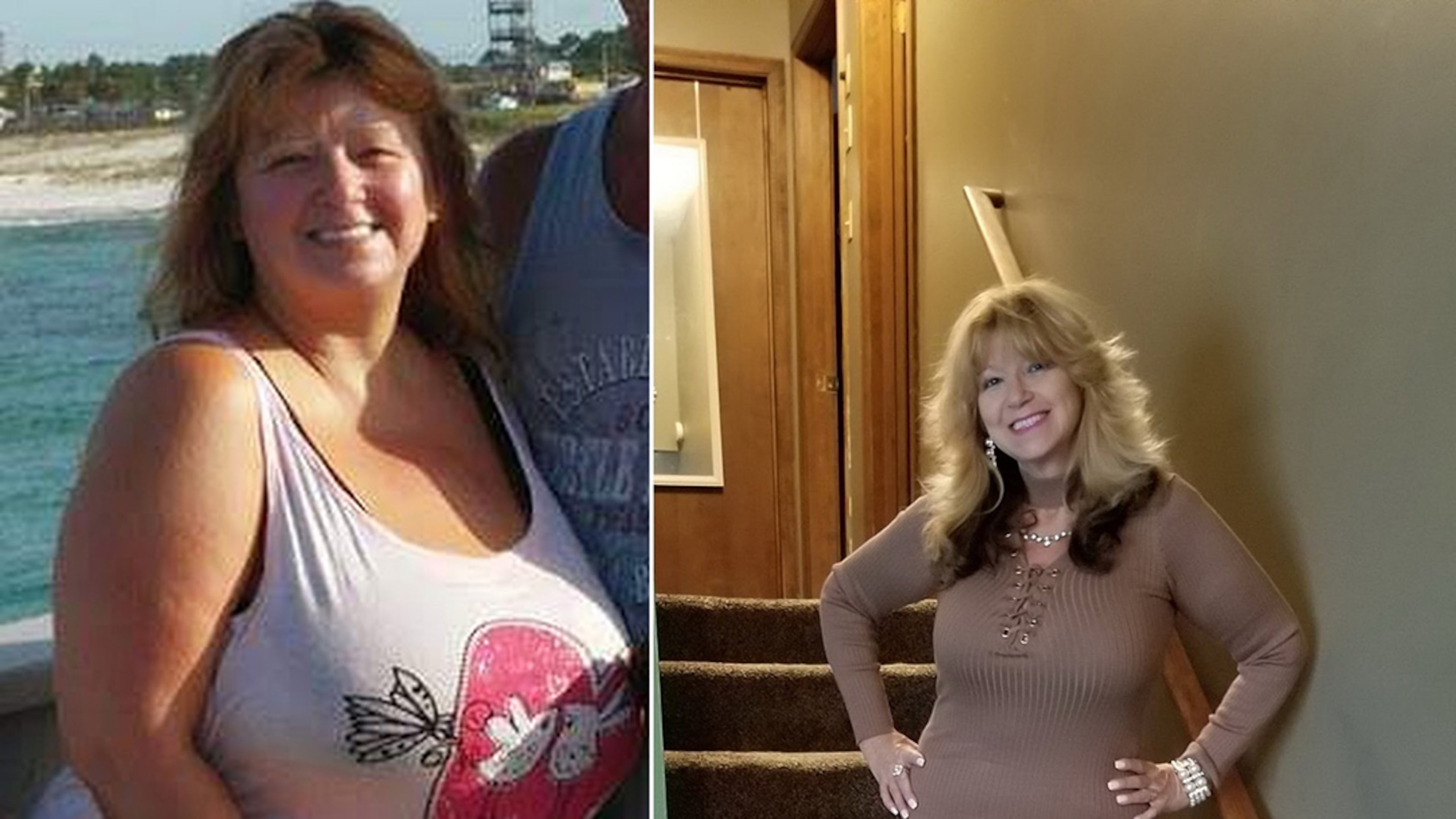 In the photo on the left, taken in 2015, Ramona Wood weighed 244 pounds. In the photo on the right, taken this past summer, she weighed 154 pounds. (All photos contributed by Ramona Wood)