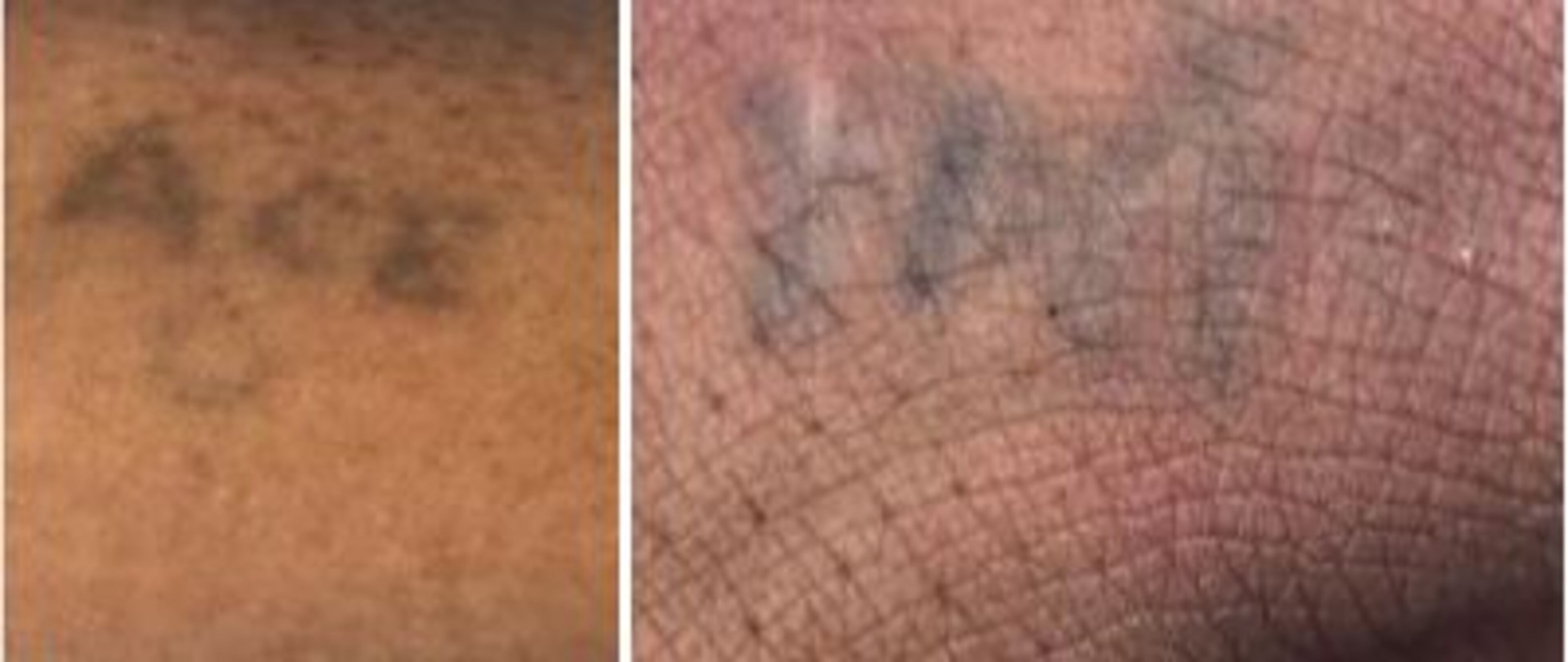 Police hope the tattoos of a teenage pedestrian struck and killed in Jonesboro earlier this month may help identify him.