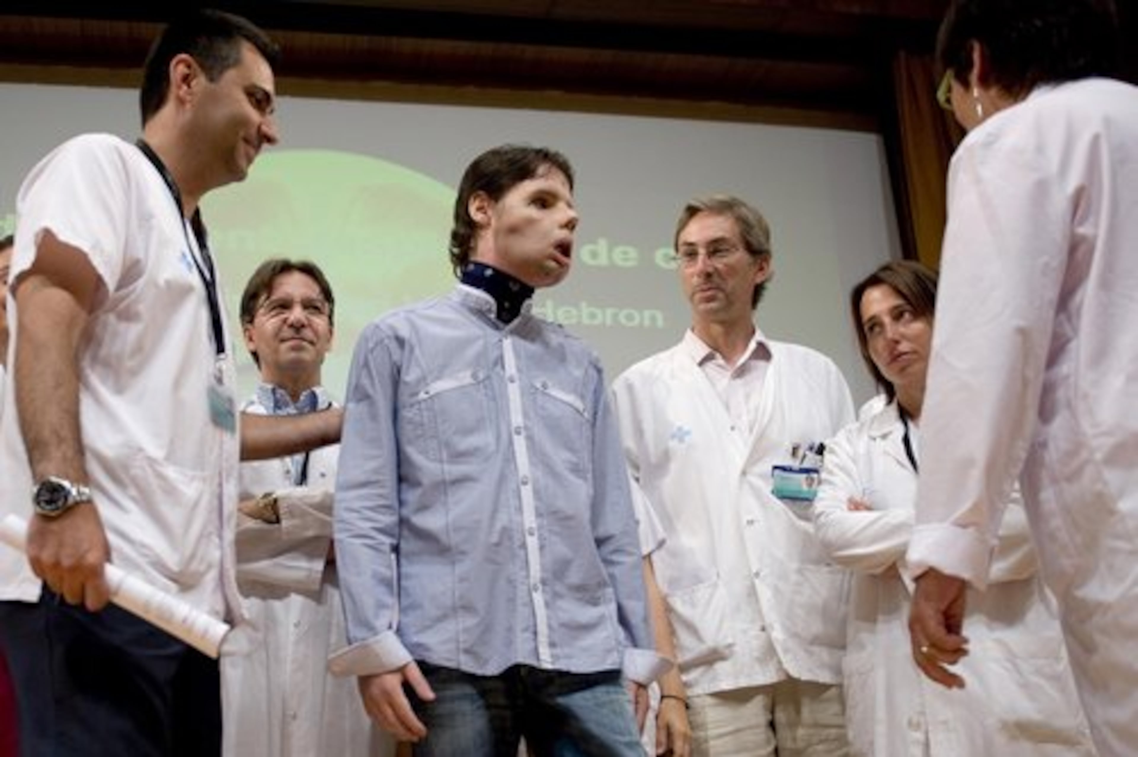 Oscar, center, a man who underwent a full-face transplant in April, stands beside Dr. Joan Barret, left, and is surrounded by doctors as he appears in public for the first time at a news conference.