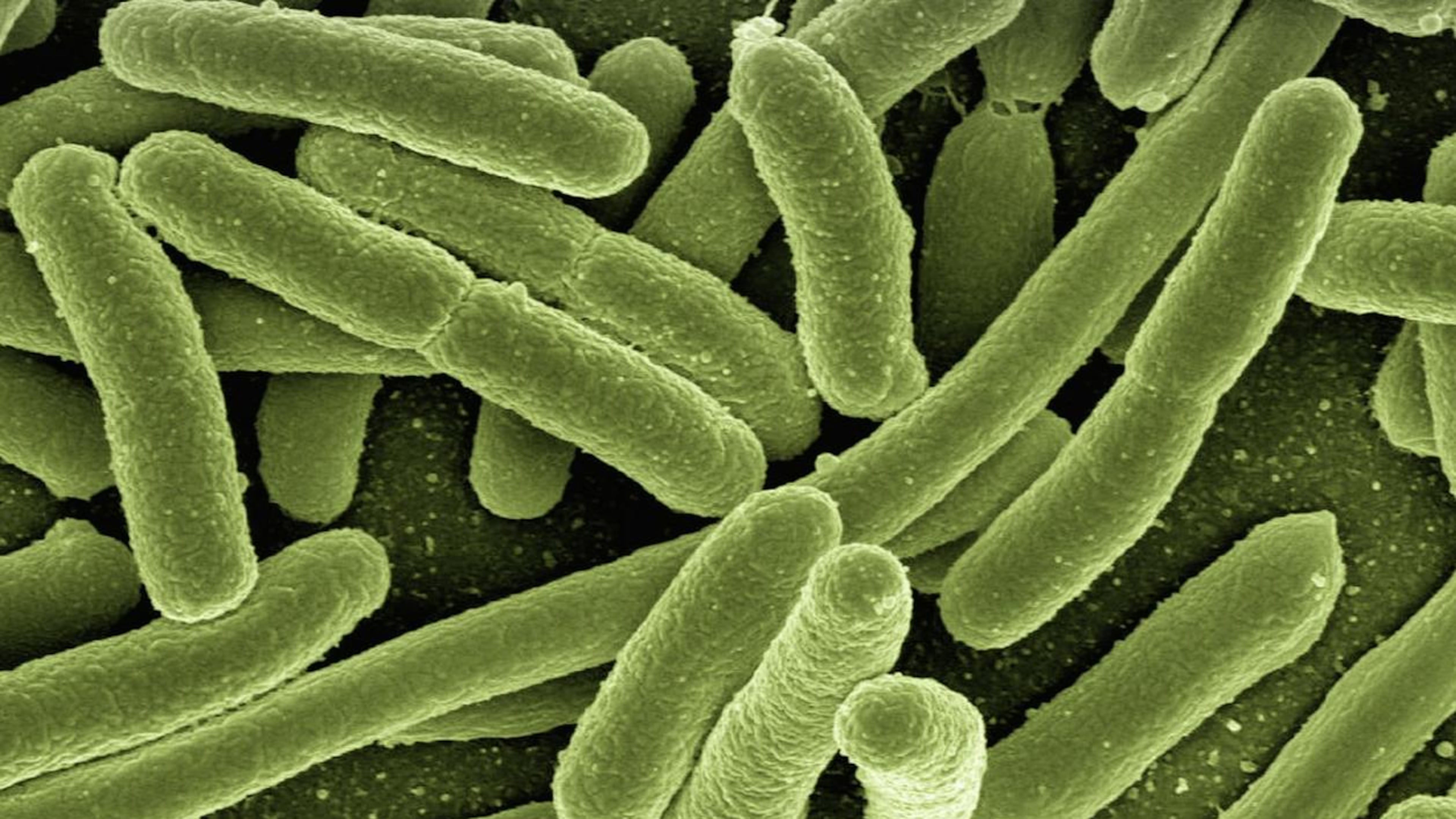 A bacteria seen under a microscope. Scientists believe hand sanitizers are becoming less effective against germs, something that is a concern in hospitals.