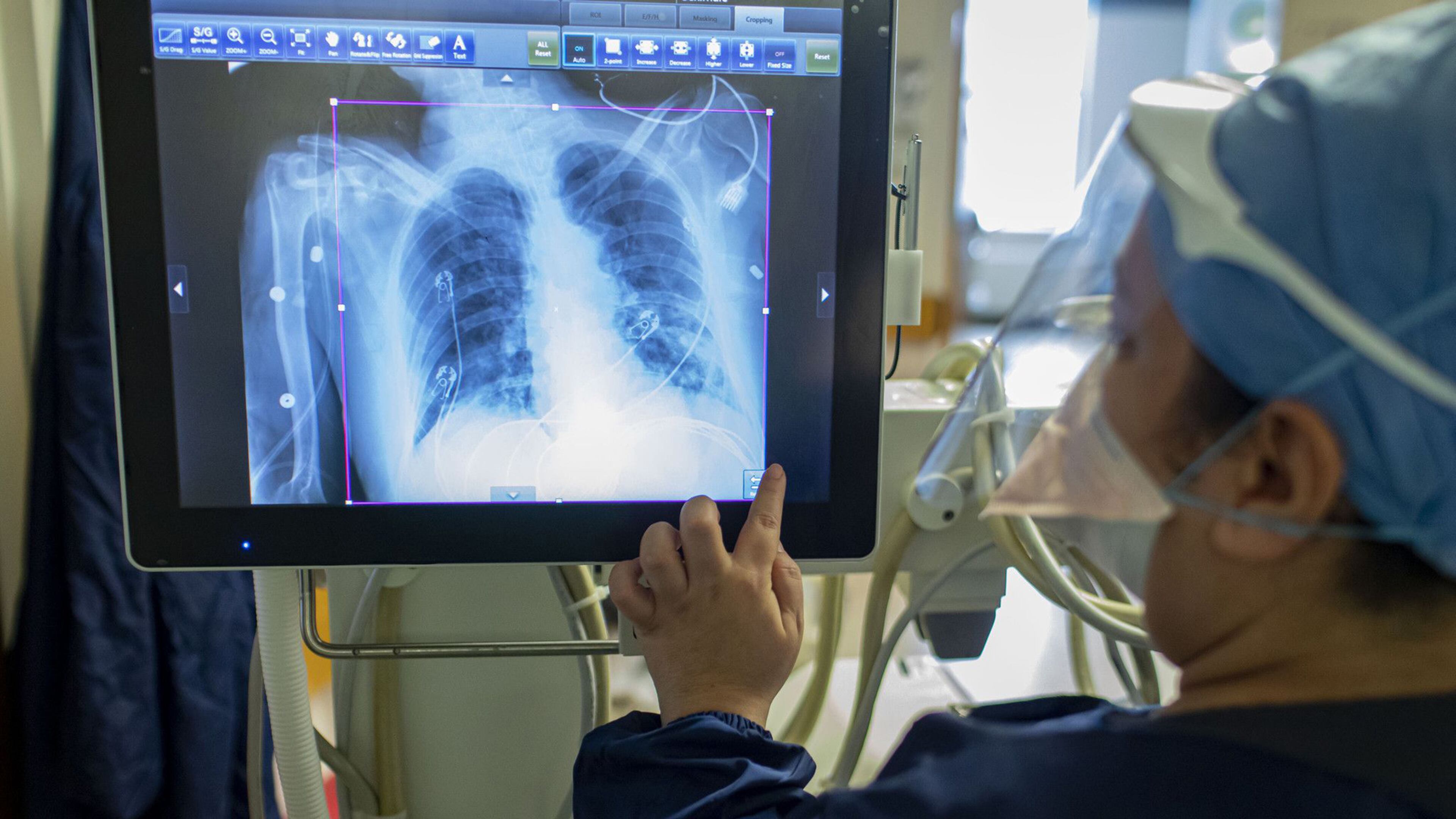 Arlene Ramirez, an MRI technologist, reviews a chest X-ray from a COVID-19 patient in the ICU on May 11, 2020, at St. Anthony Hospital in Chicago. (Brian Cassella/Chicago Tribune/TNS)