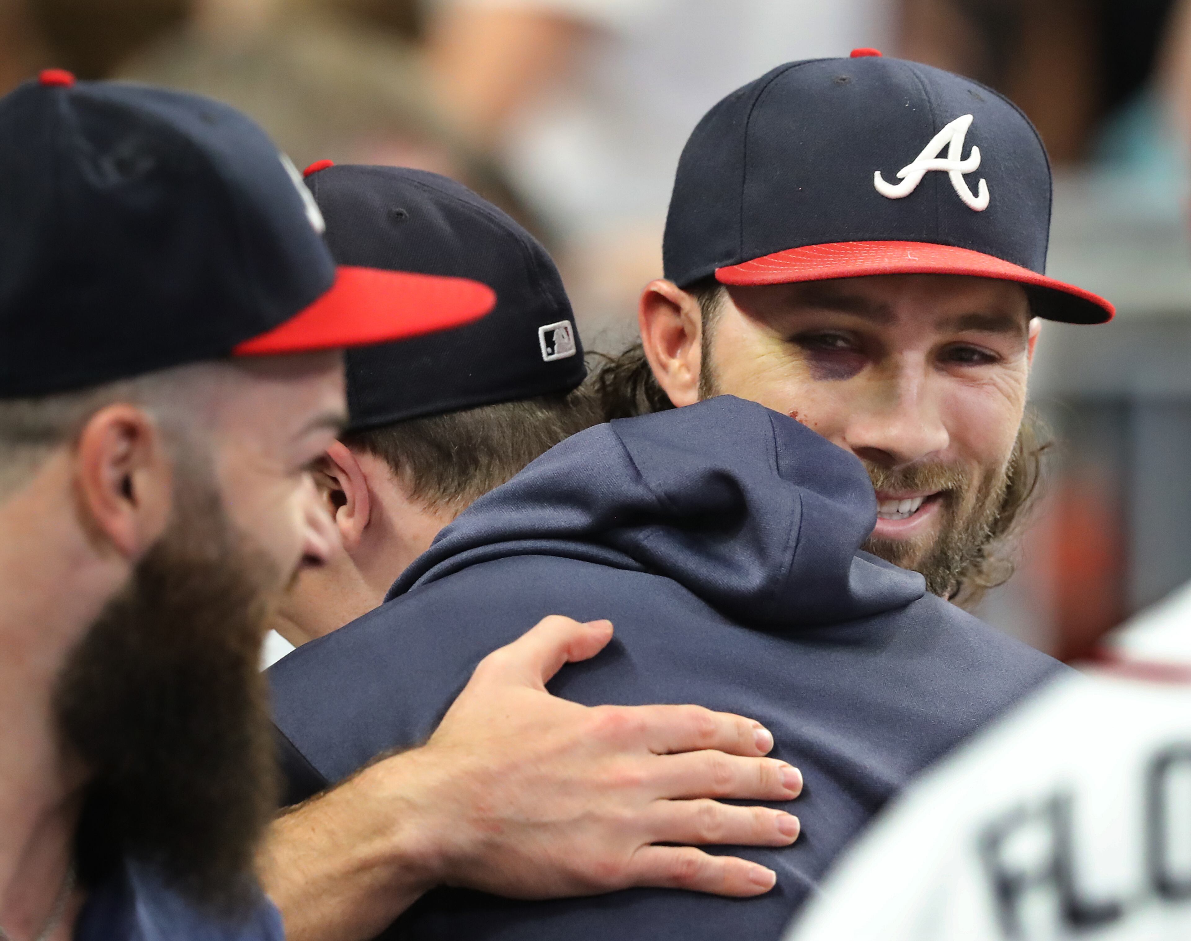 Injured Atlanta Braves player Charlie Culberson gets hugs from teammates in the dugout after he was presented the Roberto Clemente award. Curtis Compton/ccompton@ajc.com
