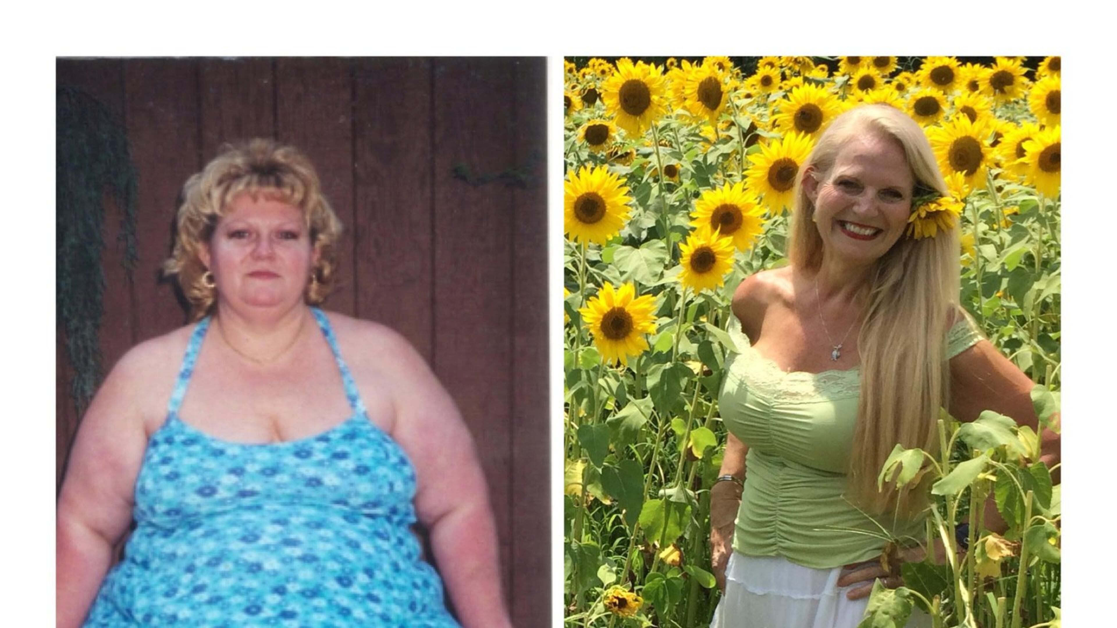 Ginger Rock, seen here before and after her gastric bypass surgery, now works as a nurse at Northside, where she facilitates a monthly Bariatric Support Group. Photo courtesy of Ginger Rock.