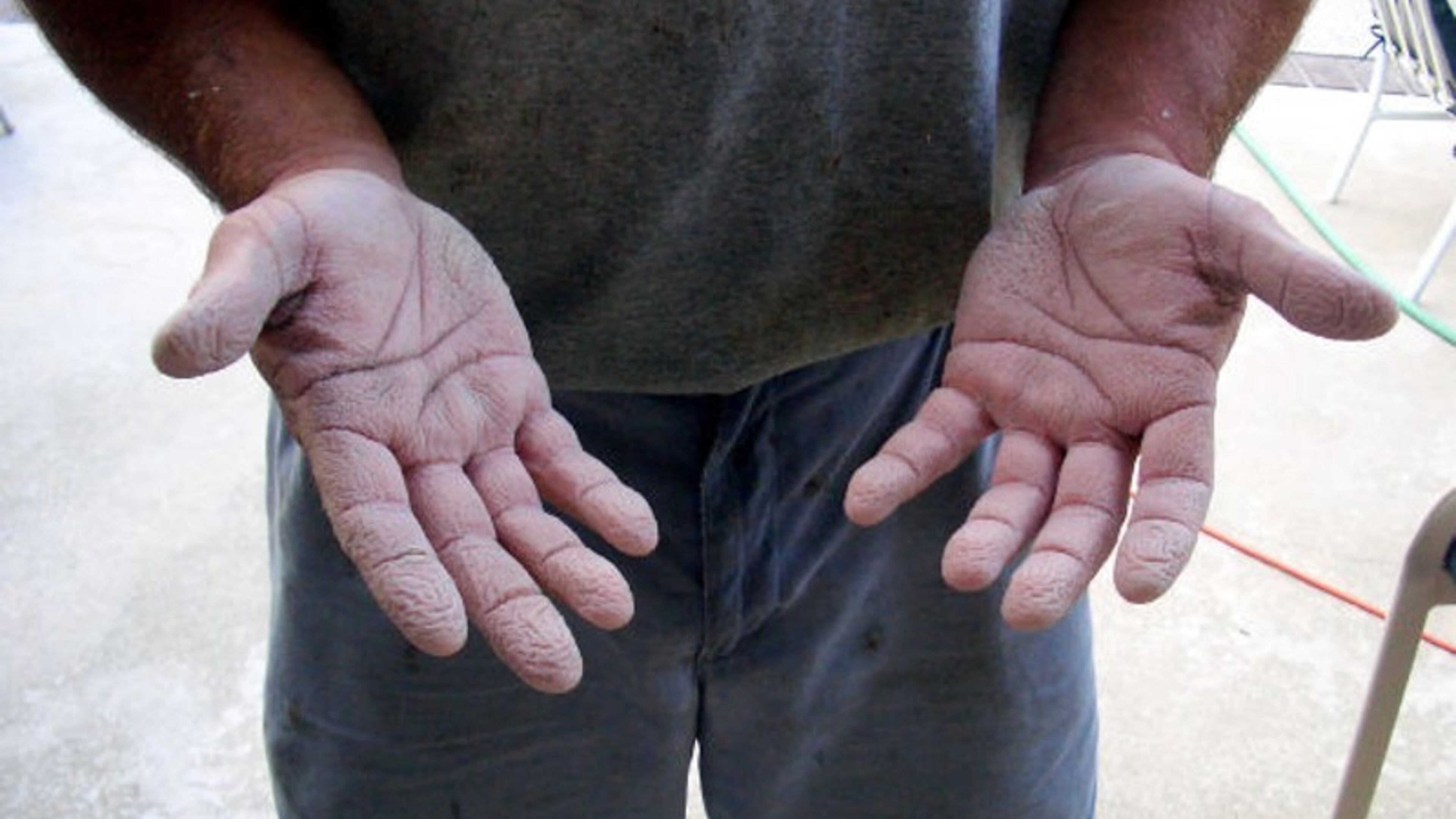 Jobless workers are losing the $600-a-week emergency pandemic supplement.