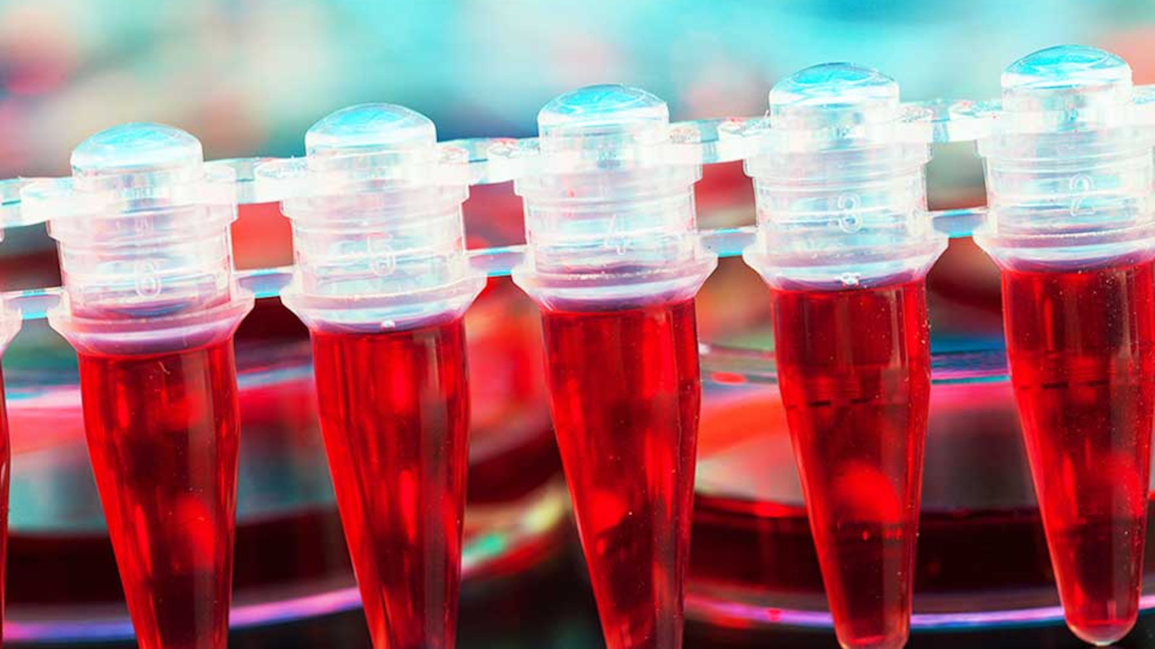 Cord blood containing stem cells, seen here, can be used in the treatment of blood cancers such as leukemias and lymphomas. However, a lawsuit filed by Georgia Attorney General Chris Carr says products used by Sandy Springs-based Elite Integrated Medical have not been approved by the FDA for marketing and distribution, nor are they covered under any investigational new drug applications that would allow for clinical use in humans. (Photo courtesy Fotolia/TNS)