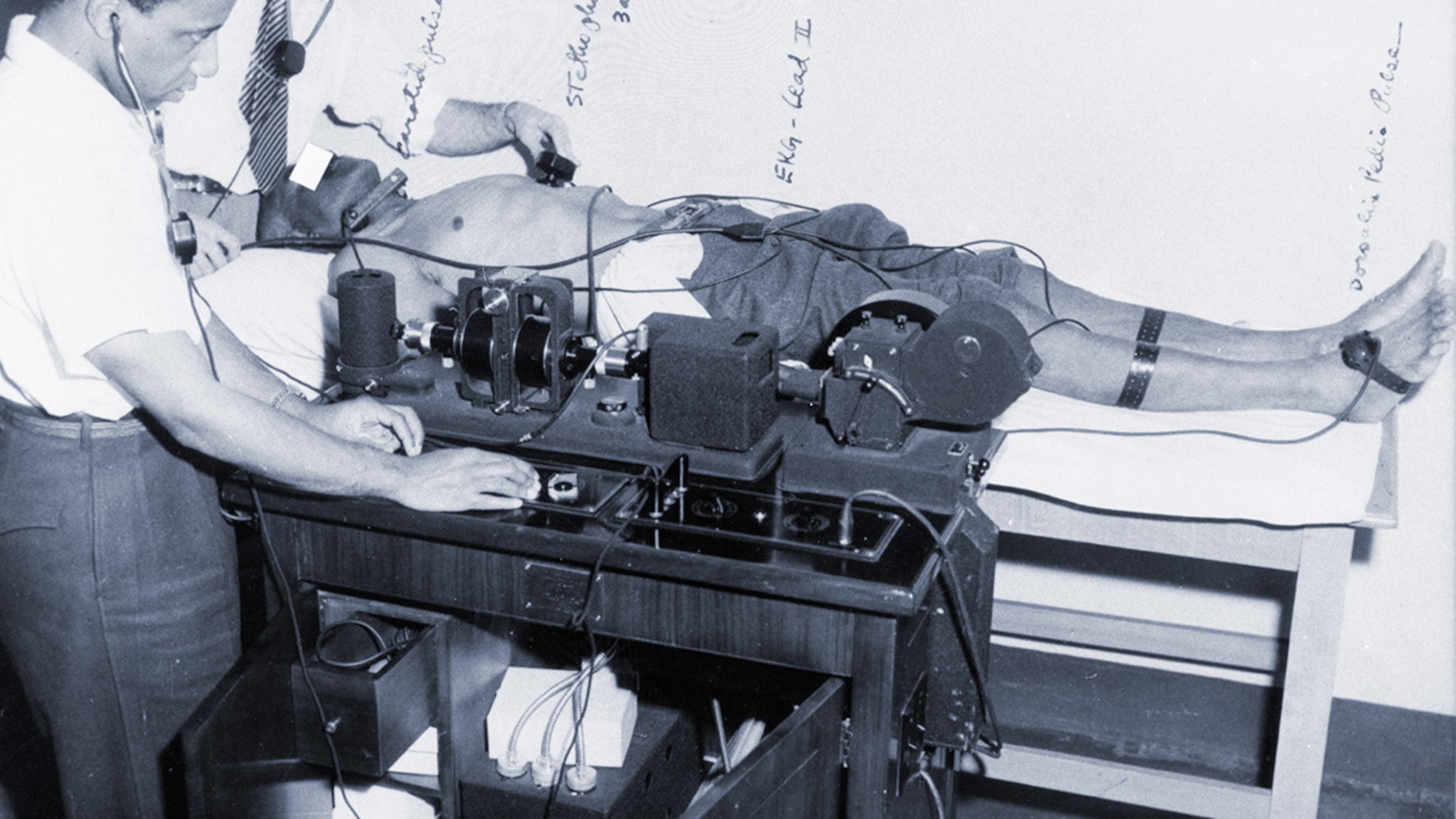 Researchers for the U.S. Public Health Service use an electrocardiogram to check the heart of a participant in the Tuskegee Syphilis Study — most likely in 1932. (Courtesy of National Archives)