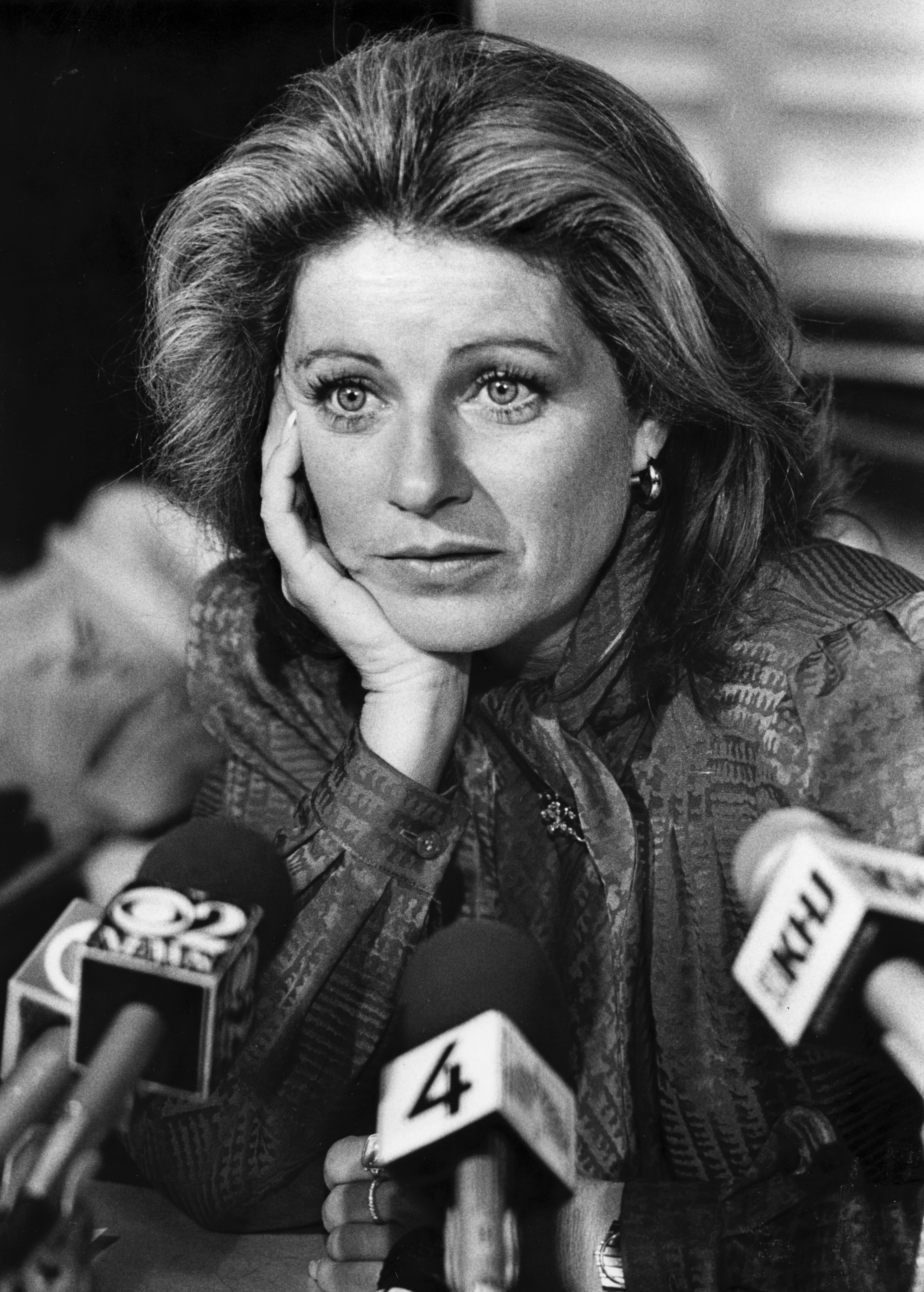 Actress Patty Duke at a West Hollywood press conference on SAG's anti-kissing stand in 1985. (Joe Kennedy/Los Angeles Times/TNS)