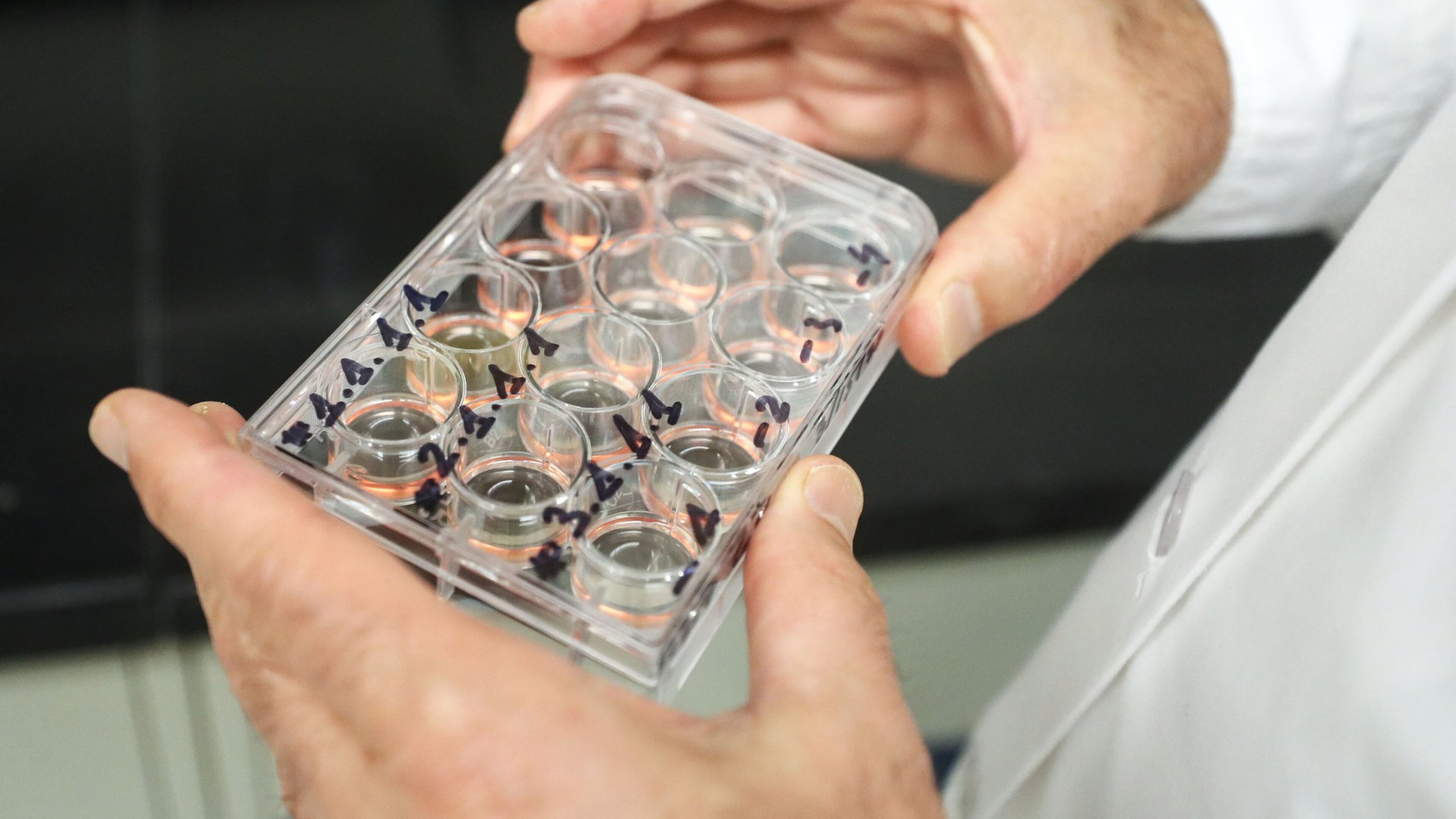 A scientist at Smyrna-based GeoVax checks a vaccine prospect for COVID-19. University labs supported by the Georgia Research Alliance are also seeking coronavirus remedies. BOB ANDRES / ROBERT.ANDRES@AJC.COM