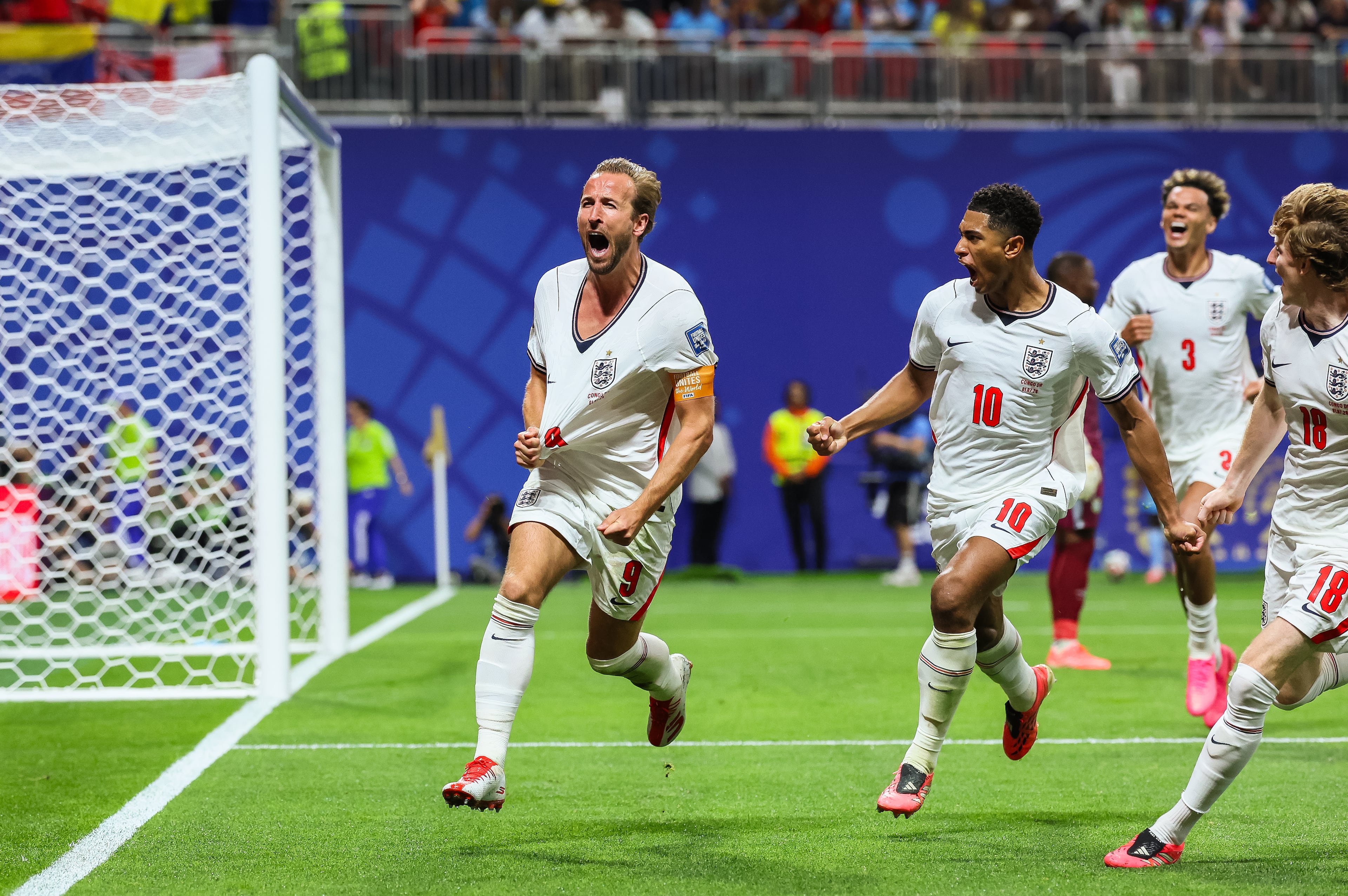 AAJC070226_WC_England_Congo
