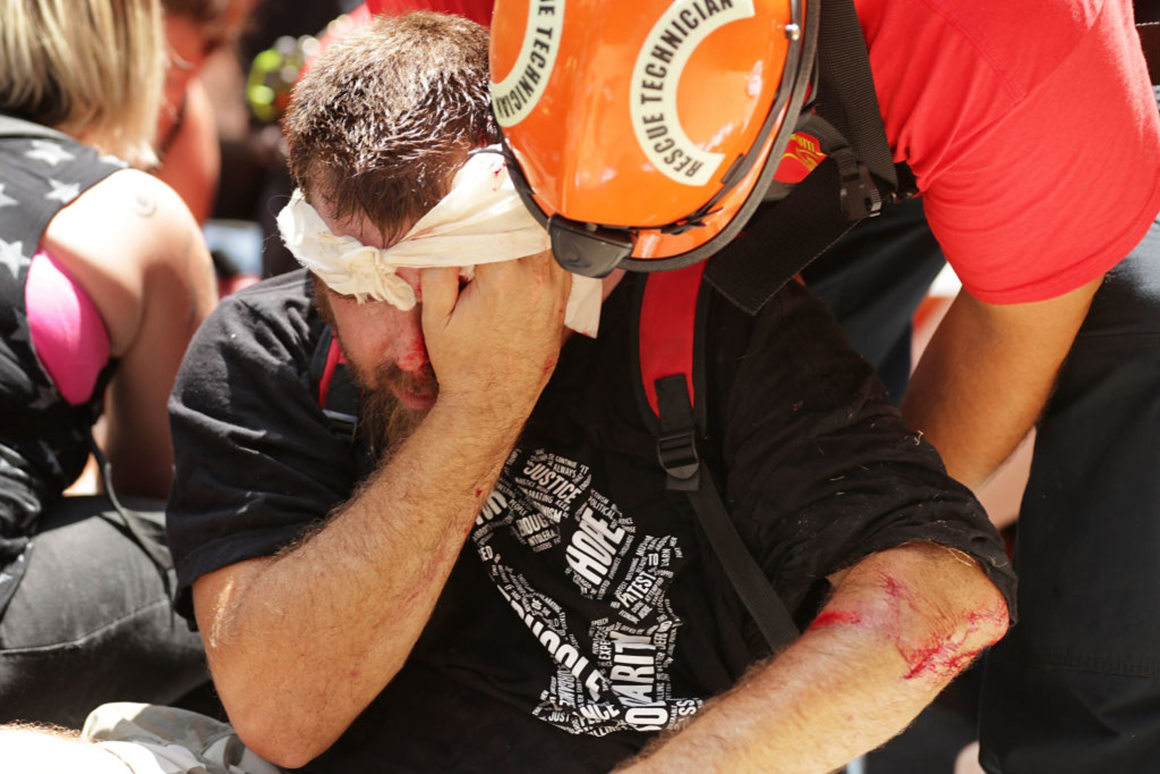 CHARLOTTESVILLE, VA - AUGUST 12: Rescue workers and medics tend to many people who were injured when a car plowed through a crowd of anti-facist counter-demonstrators marching through the downtown shopping district August 12, 2017 in Charlottesville, Virginia. The car plowed through the crowed following the shutdown of the "Unite the Right" rally by police after white nationalists, neo-Nazis and members of the "alt-right" and counter-protesters clashed near Lee Park, where a statue of Confederate General Robert E. Lee is slated to be removed. (Photo by Chip Somodevilla/Getty Images)