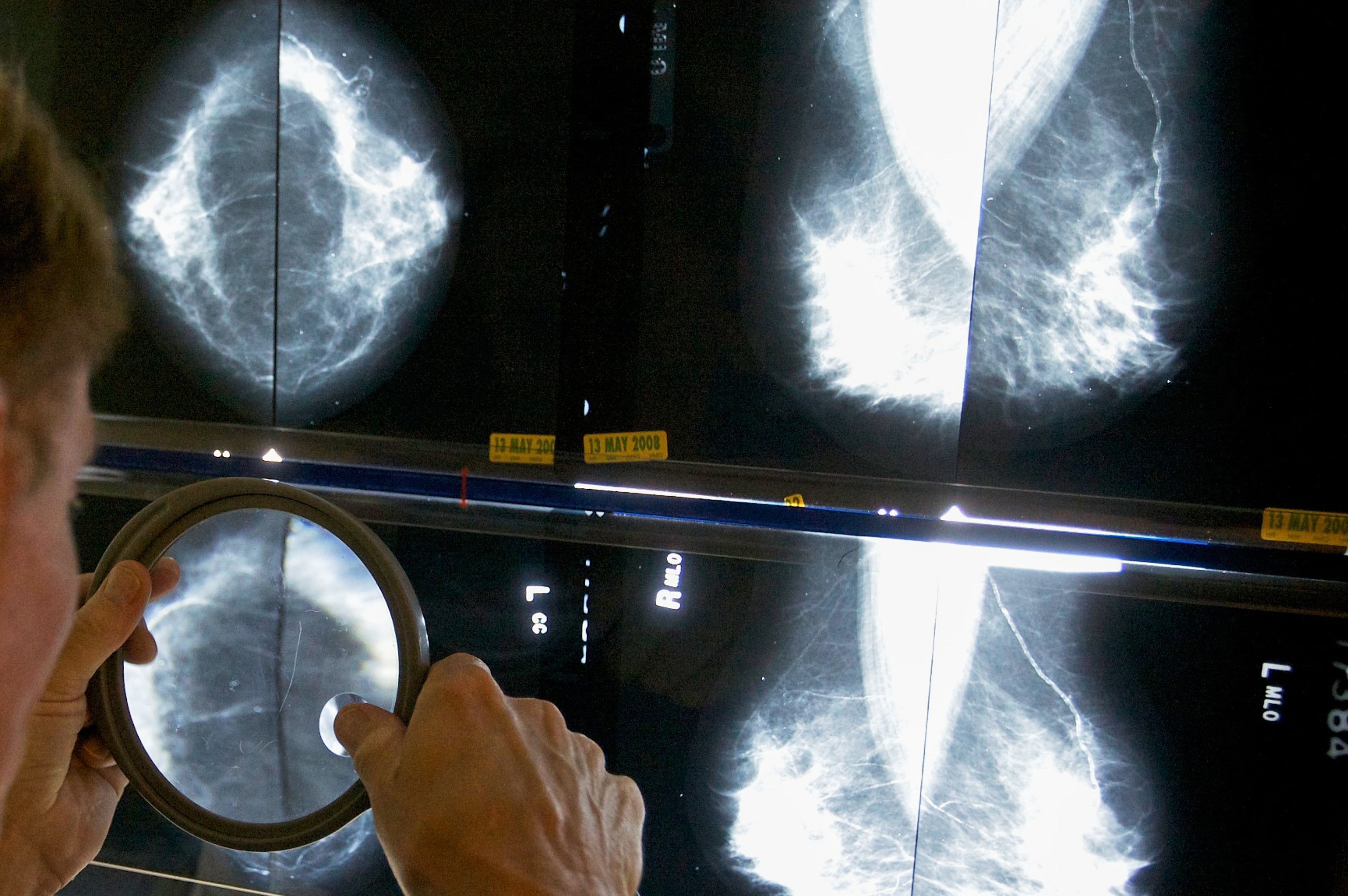 Be Well-Mammograms