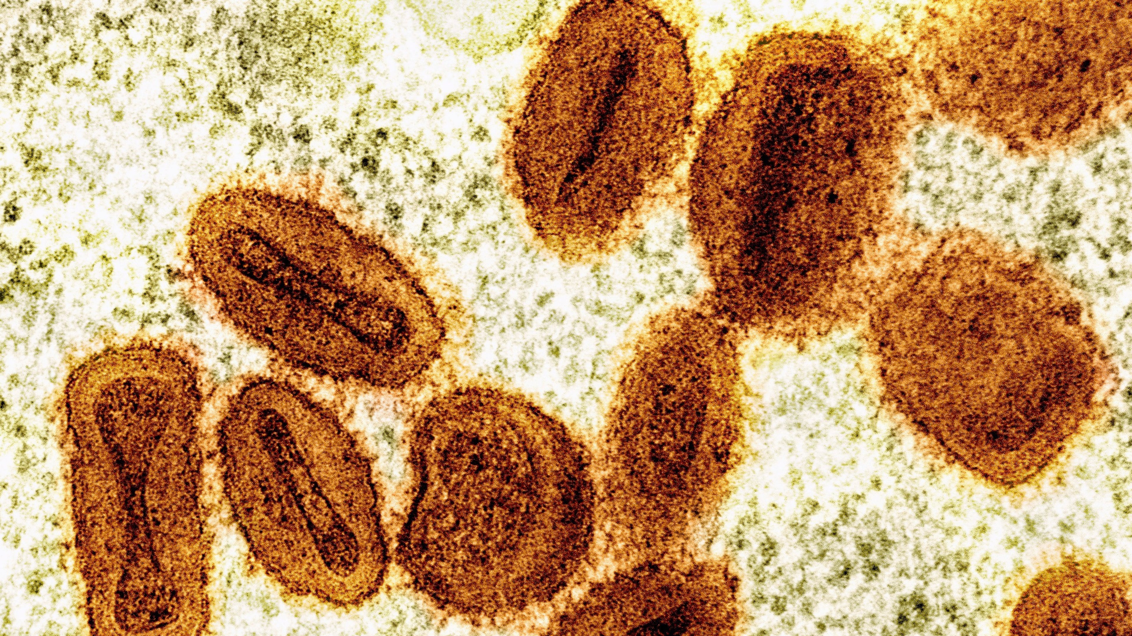 FILE - This colorized electron microscope image provided by the National Institute of Allergy and Infectious Diseases in 2024 shows Mpox virus particles, orange, found within infected cells, green. (NIAID via AP, File)