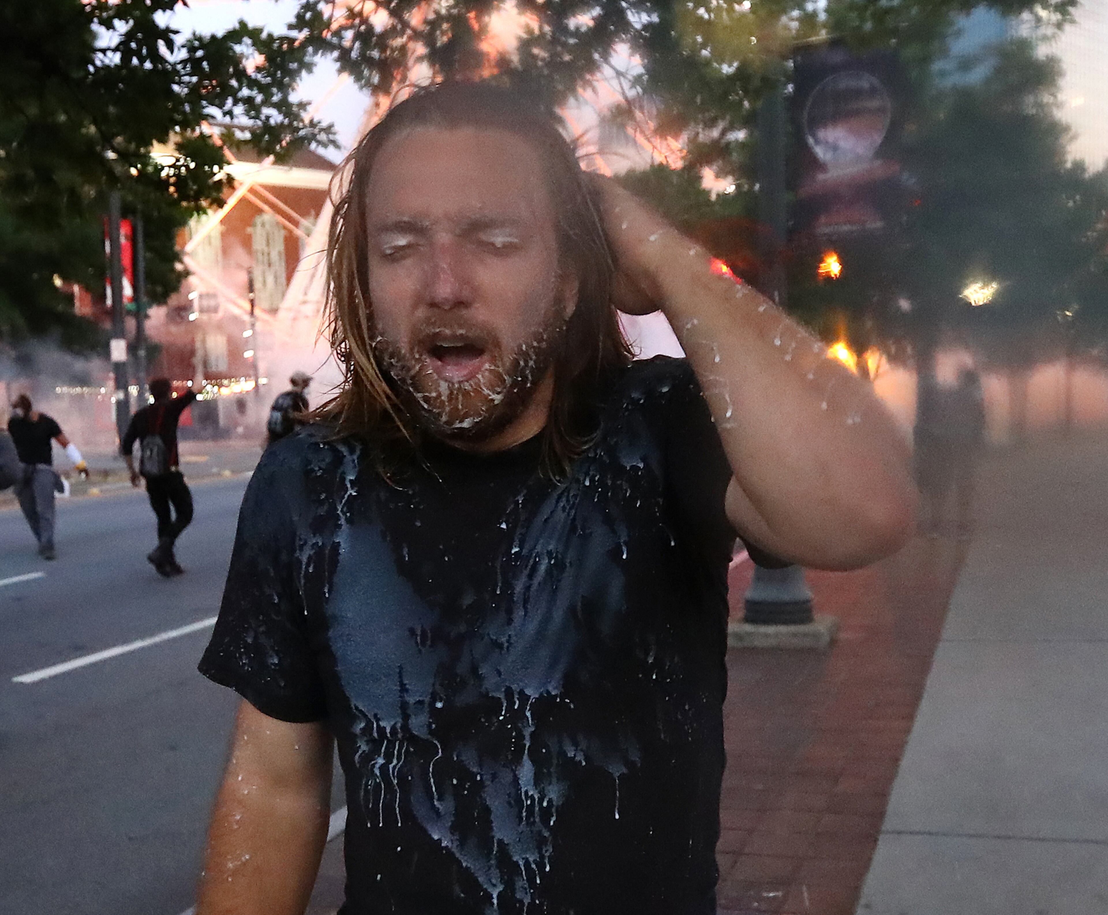 053120 Atlanta: RA protester reacts to being hit with tear gas during the third day of protests over the death of George Floyd on Sunday, May 31, 2020, in Atlanta. Curtis Compton ccompton@ajc.com