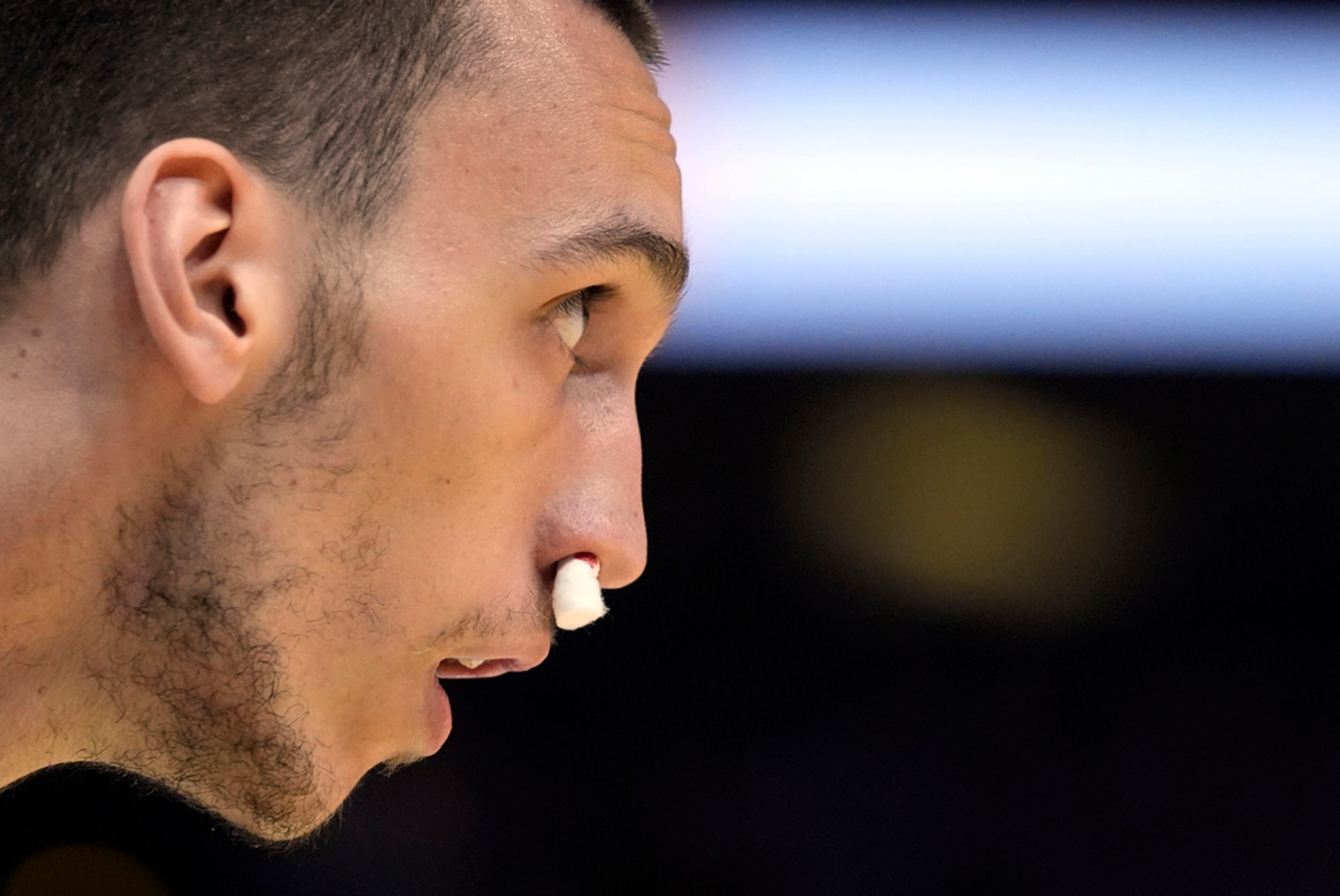 Charlotte Hornets forward Aleksej Pokusevski (17) wears cotton in nose to stop bleeding during the first half of an NBA basketball game against the Atlanta Hawks Saturday, March 23, 2024, in Atlanta. (AP Photo/John Bazemore)