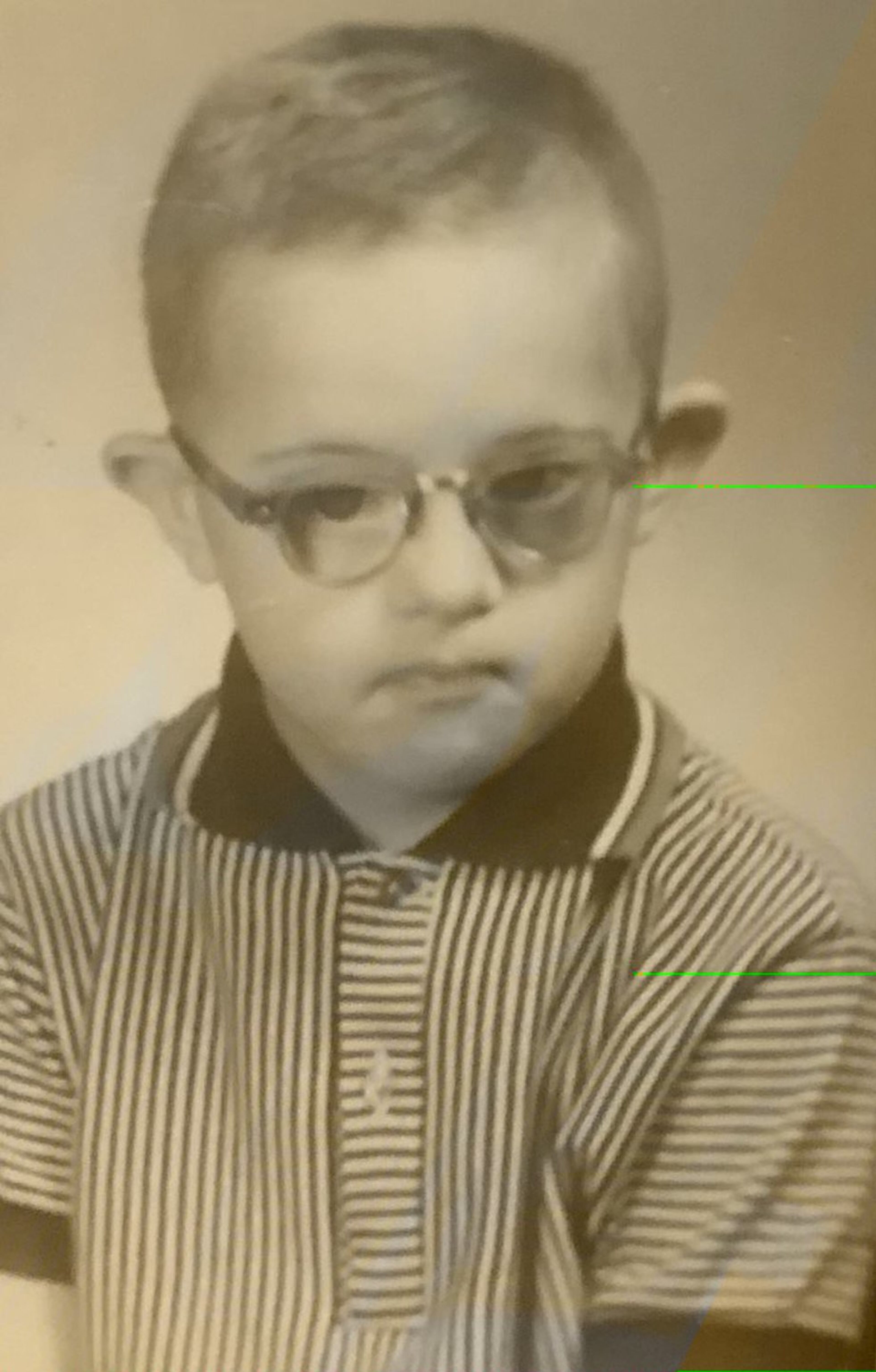 Benton, 7, in 1959. The average life expectancy for people with Down syndrome is 60, with many living well beyond that age, according to the National Association for Down Syndrome.