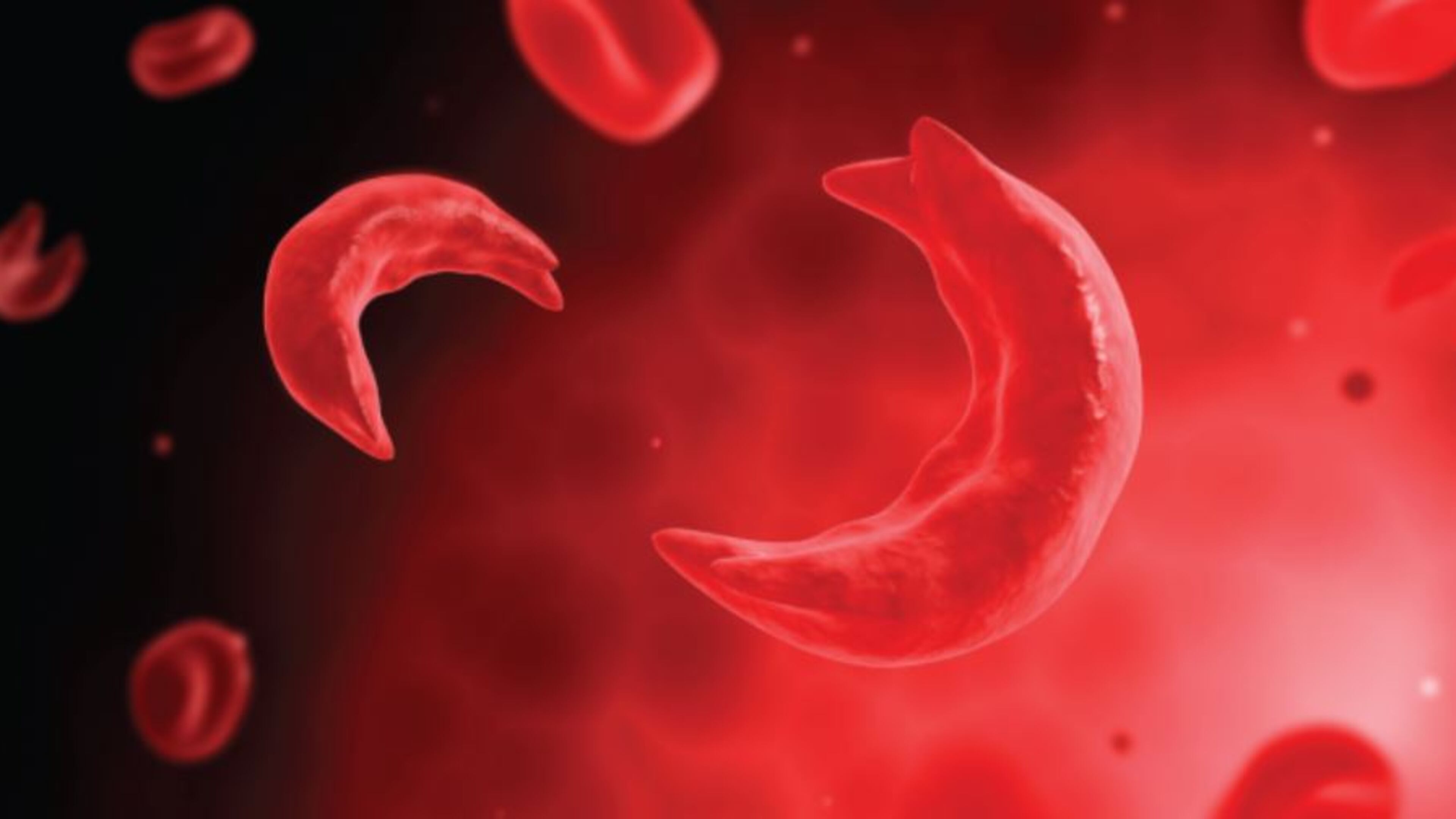 Understanding and effectively treating the group of blood disorders that is sickle cell disease should be a community priority.